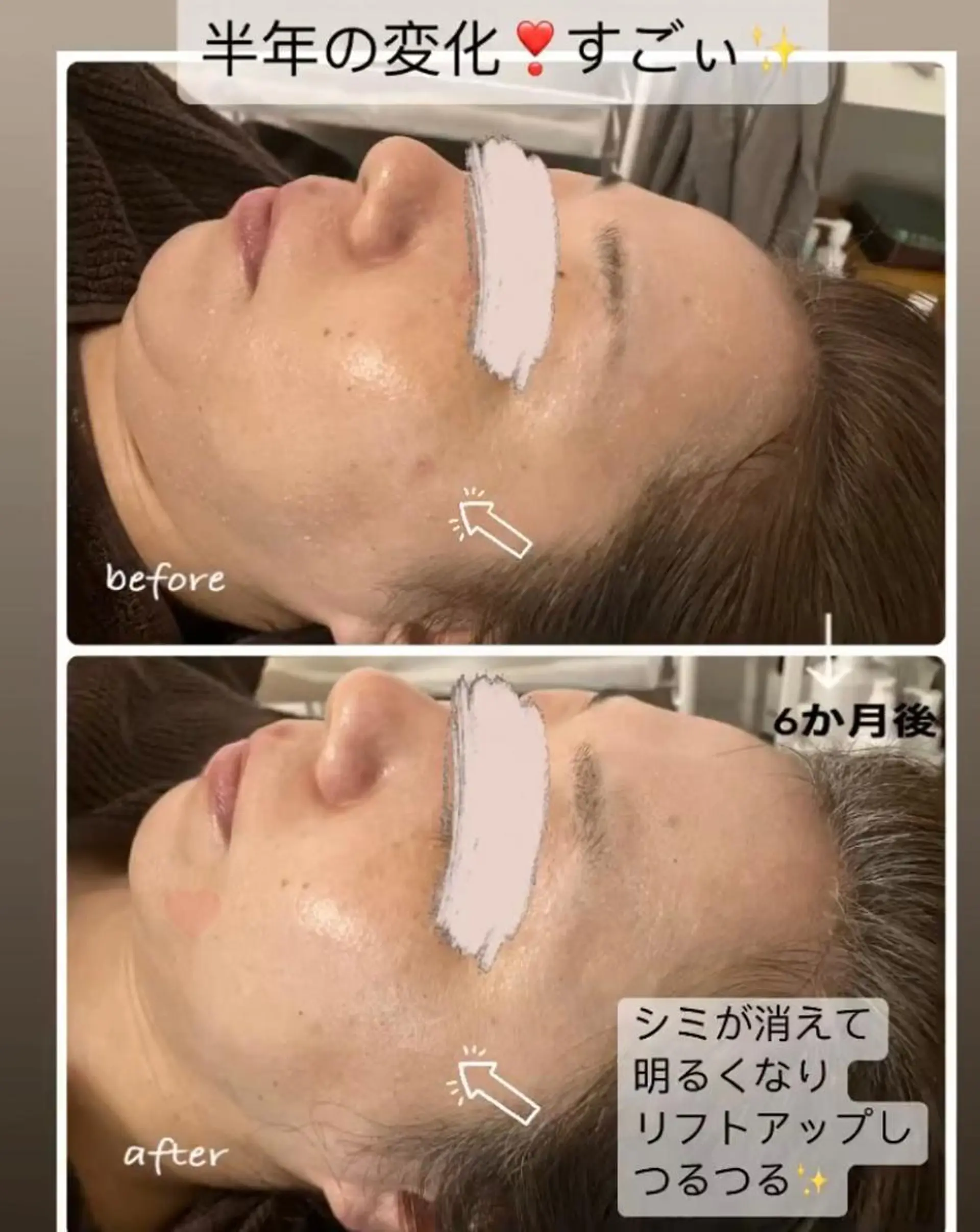 エステ luana beauty所属・kana ハーブピーリング🌿のエステ・リラクイメージ