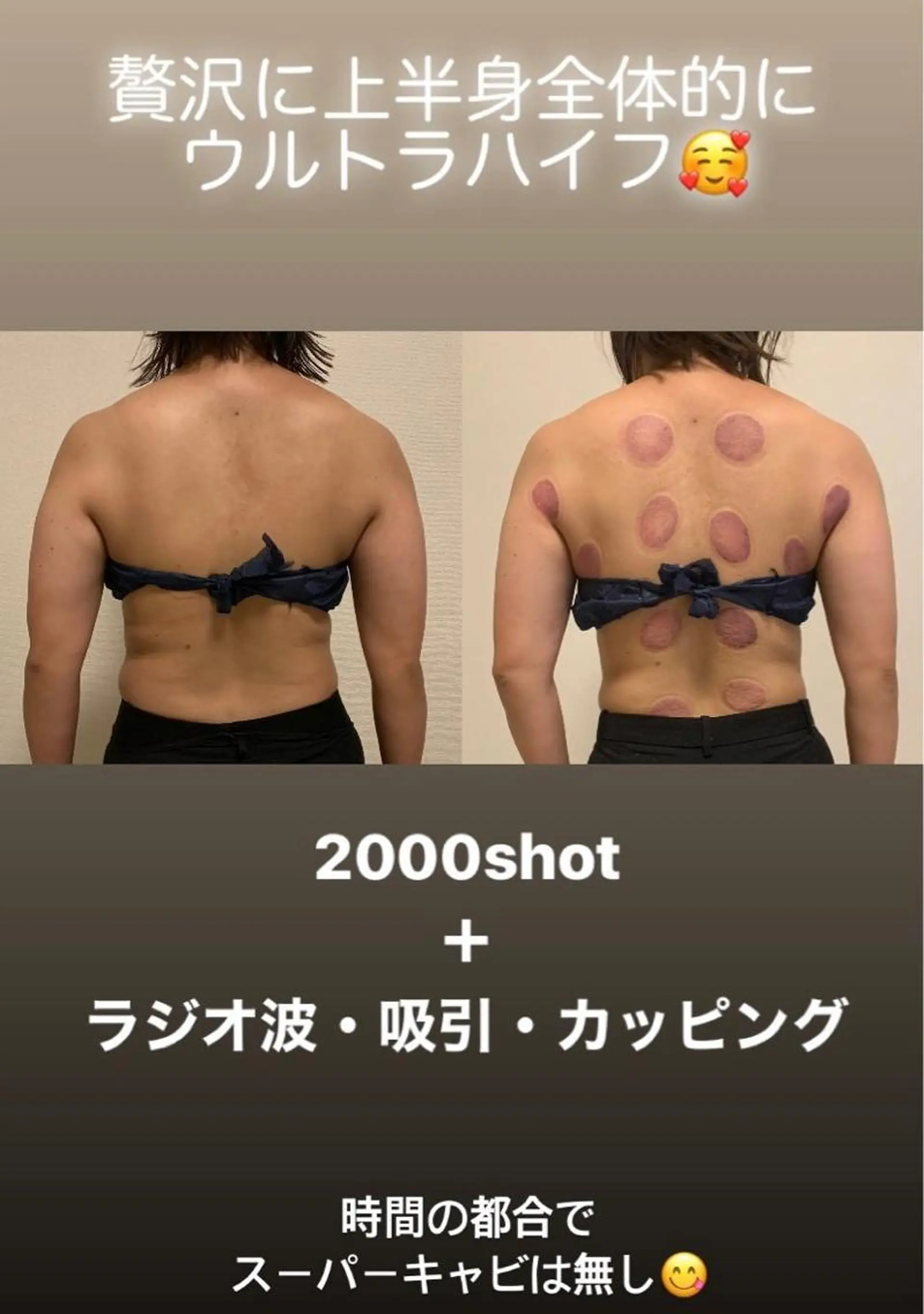 a  room salonのエステ・リラクイメージ