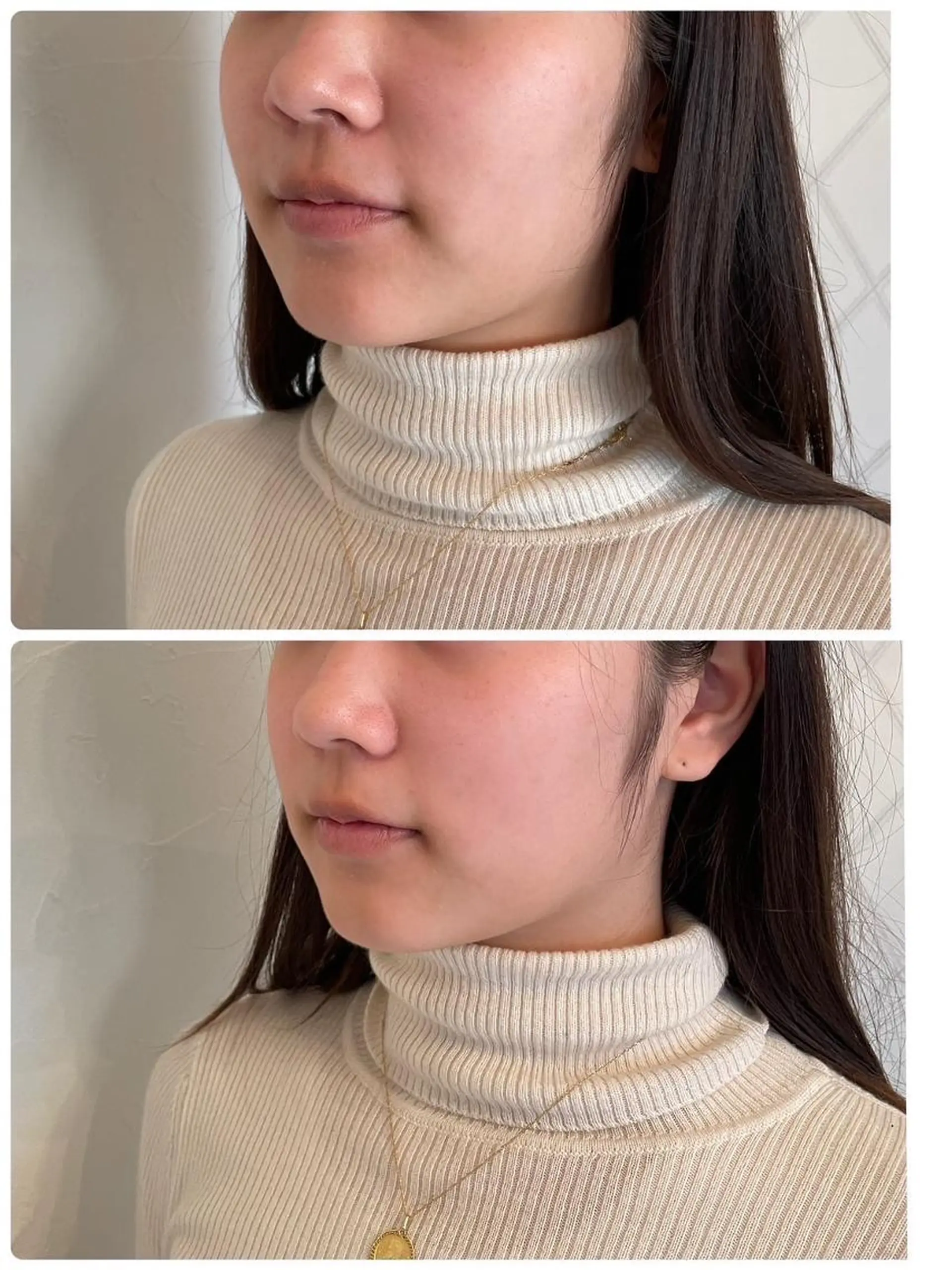 エステ リラク 痛くない垢抜け小顔& 姿勢⭐︎AQUA-Bのエステ・リラクイメージ