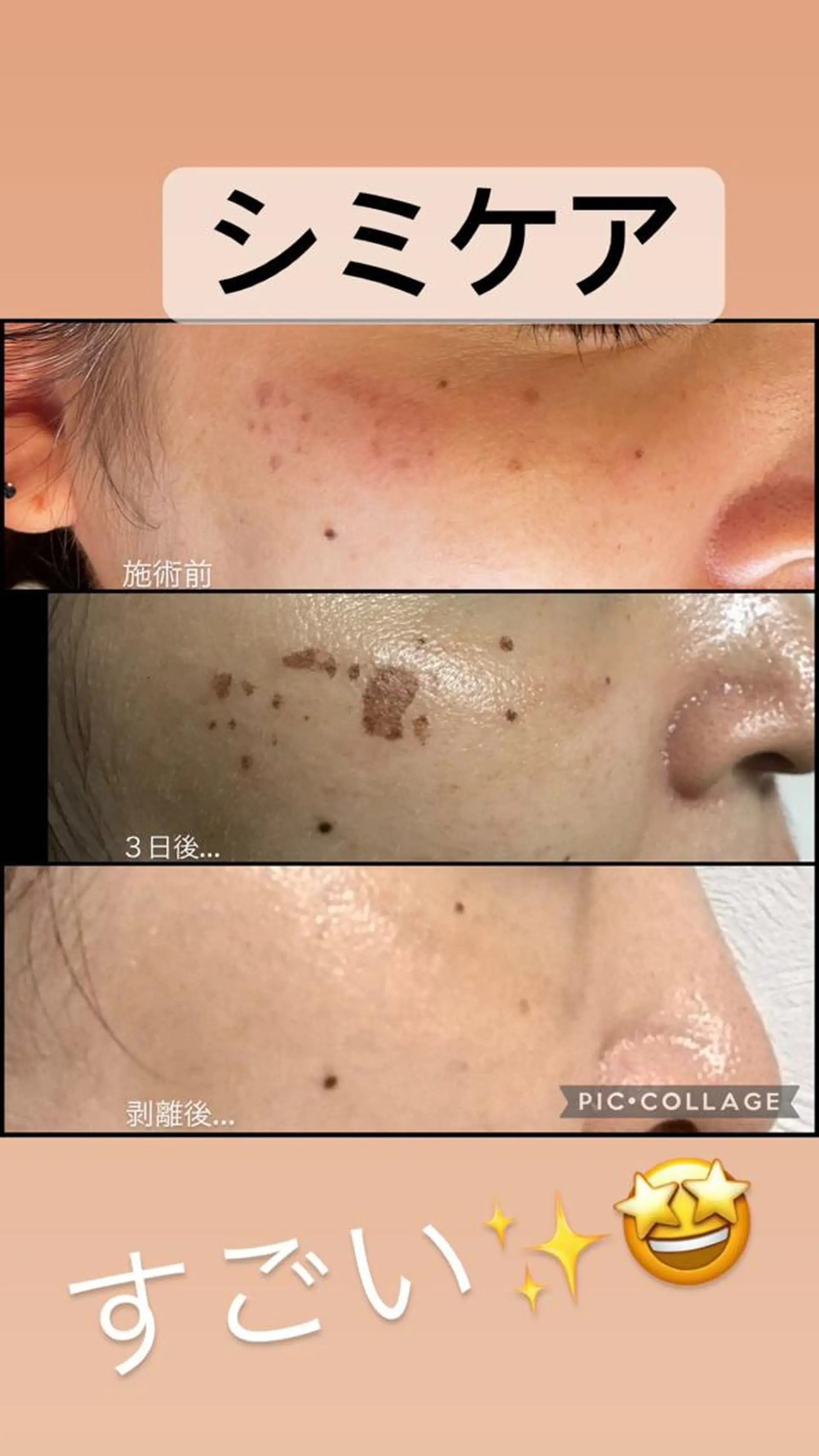 ANGEL NAIL所属・RE:BORN 大阪四條畷市のエステ・リラクイメージ