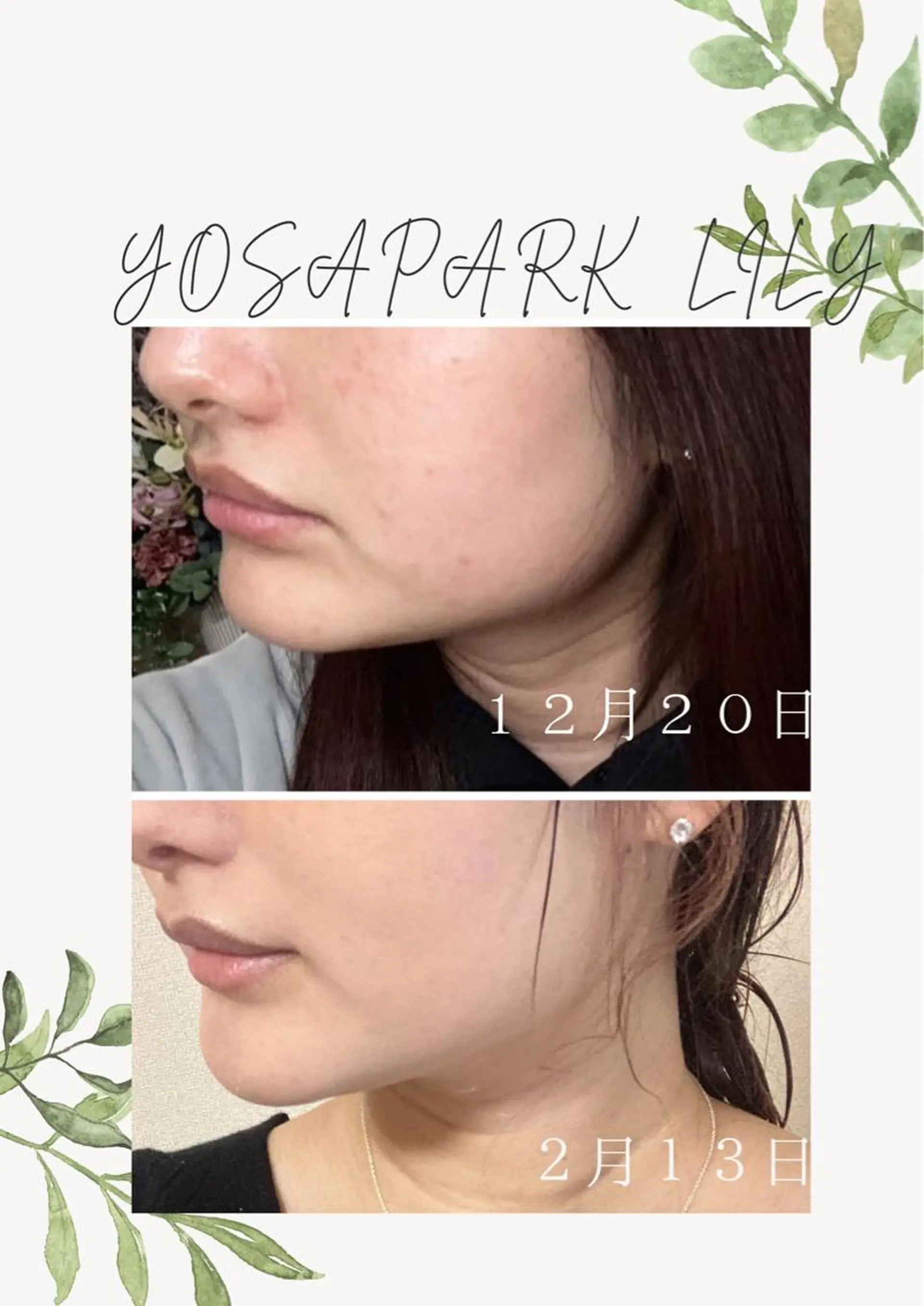 エステ 温活痩身サロン LILYのエステ・リラクイメージ