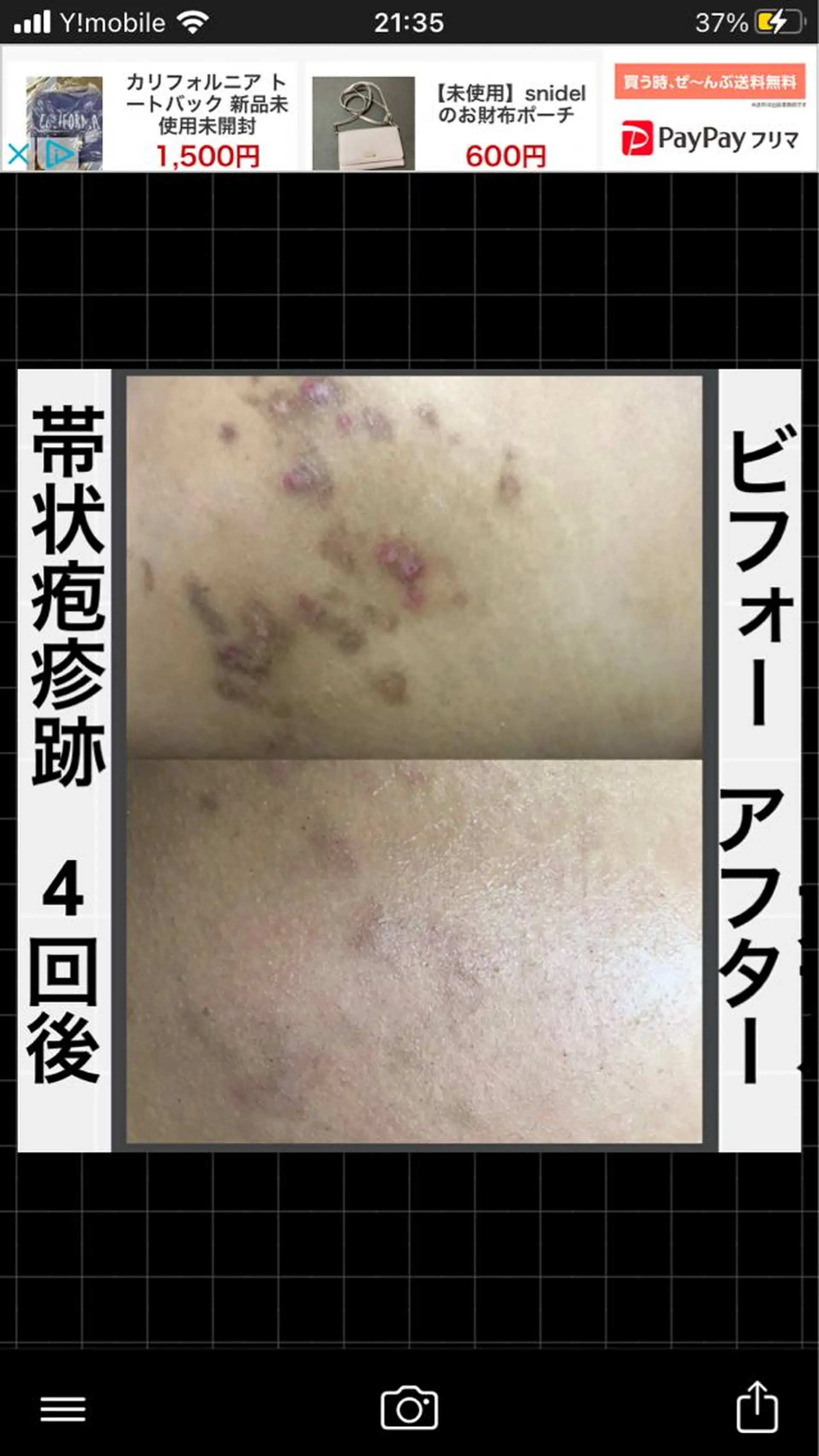 ショート カラー パーマ ヘアアレンジ メンズ キッズ ネイル マツエク・マツパ アイブロウ エステ ハーブピーリング専門 🌿モッカのエステ・リラクイメージ