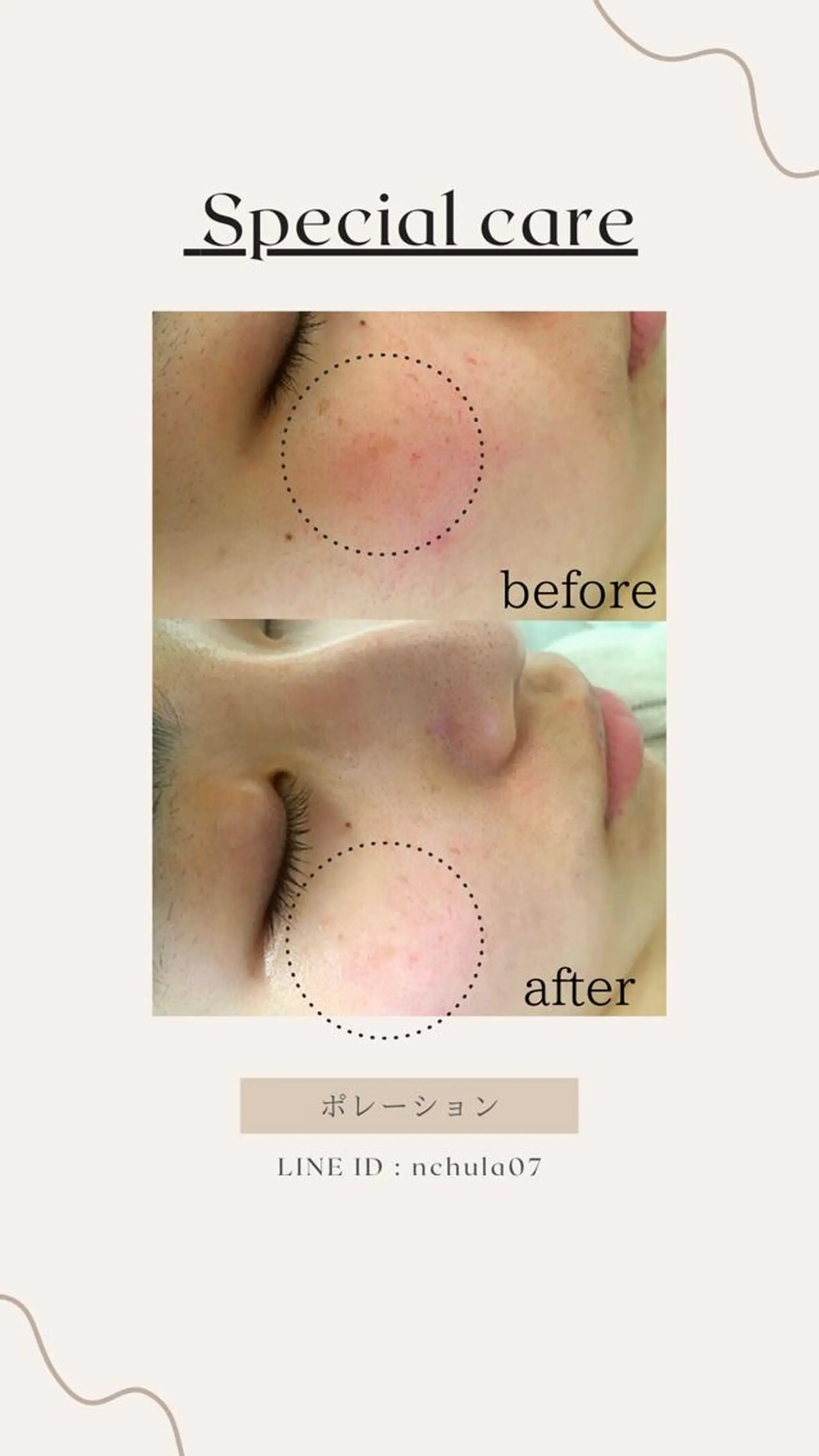 KOHAKU.所属・Nana Kikutaのエステ・リラクイメージ