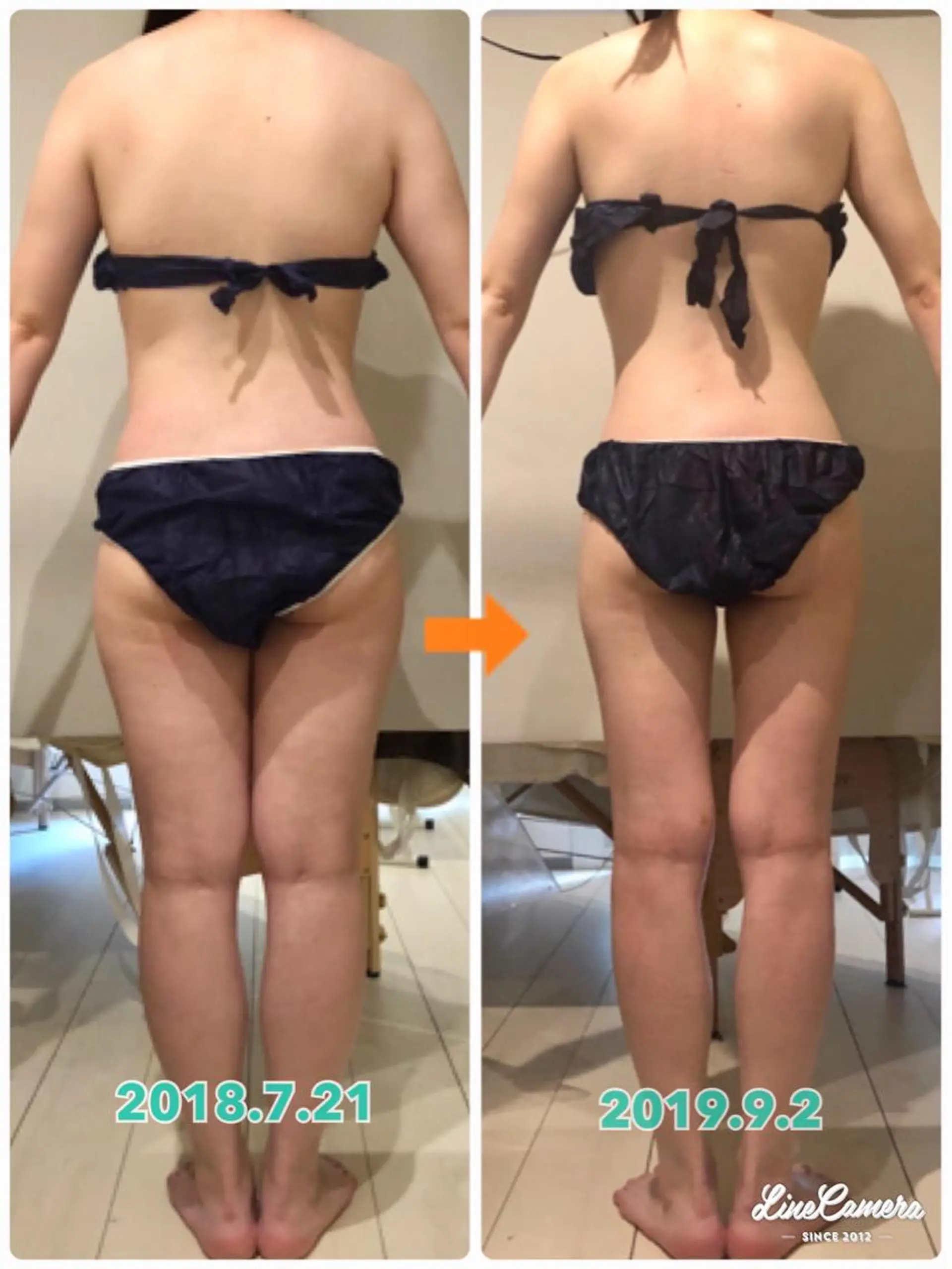 ショート カラー パーマ ヘアアレンジ メンズ キッズ ネイル マツエク・マツパ ‍痩身＆ボディ 結果出し🌟丹野のエステ・リラクイメージ