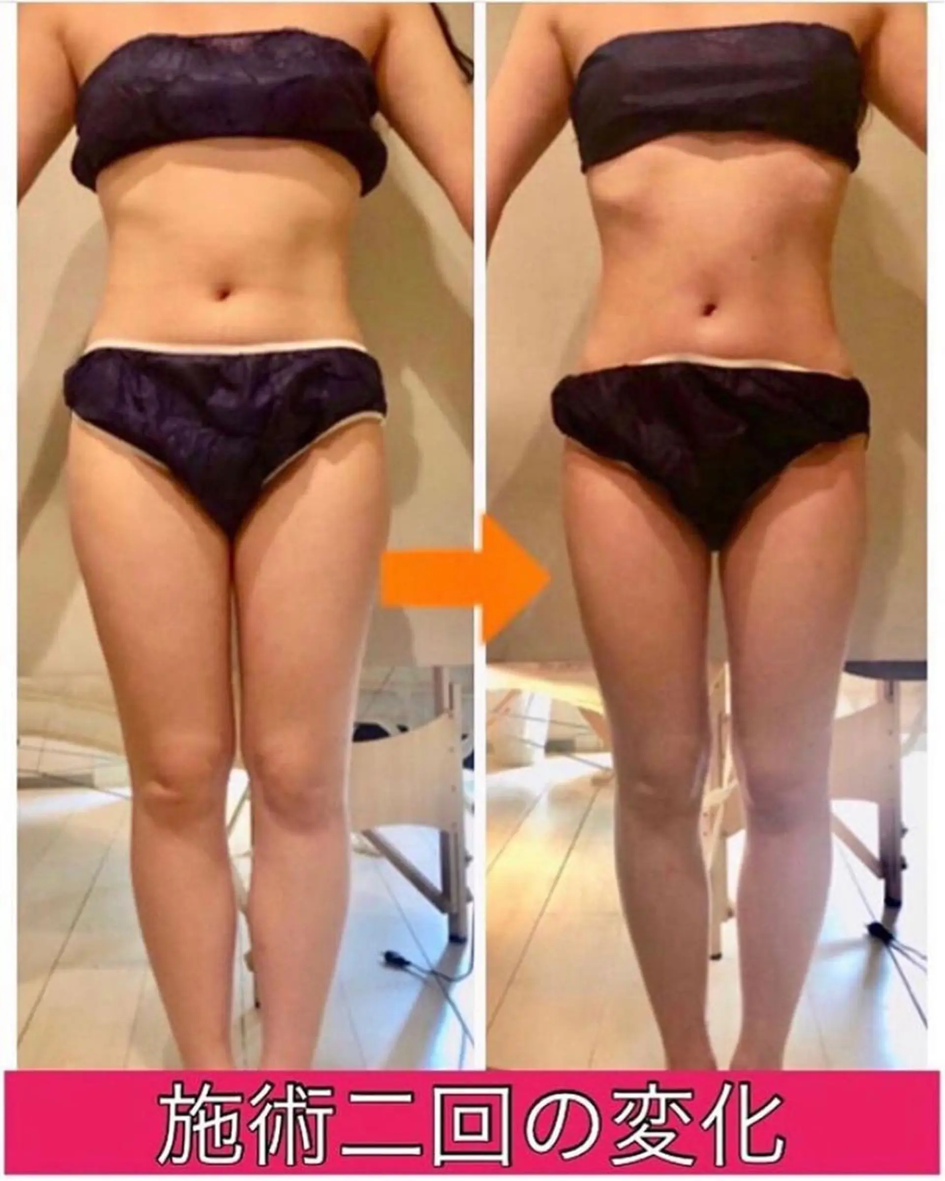 ショート カラー パーマ ヘアアレンジ メンズ キッズ ネイル マツエク・マツパ ‍痩身＆ボディ 結果出し🌟丹野のエステ・リラクイメージ