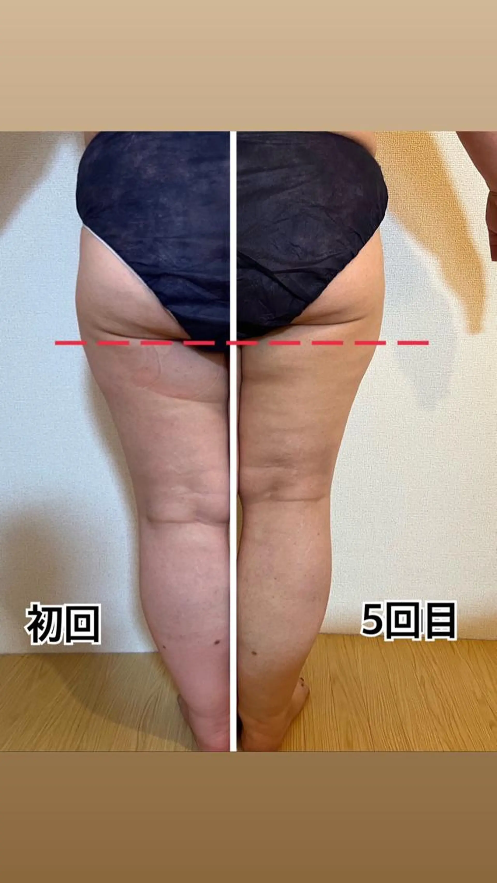 ❤︎MN❤︎ モンのエステ・リラクイメージ