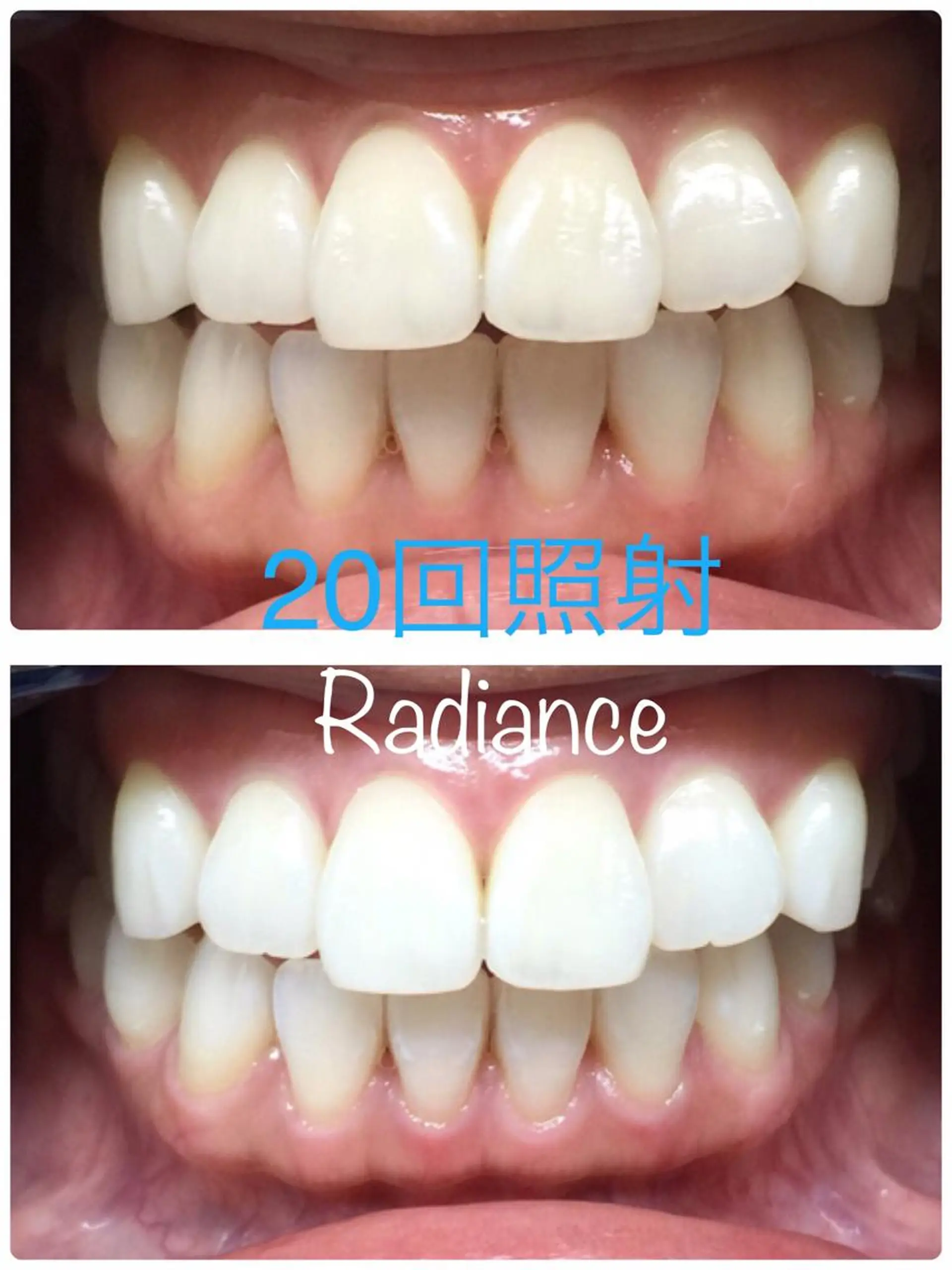 札幌ホワイトニング ラディアンス札幌駅店のその他イメージ