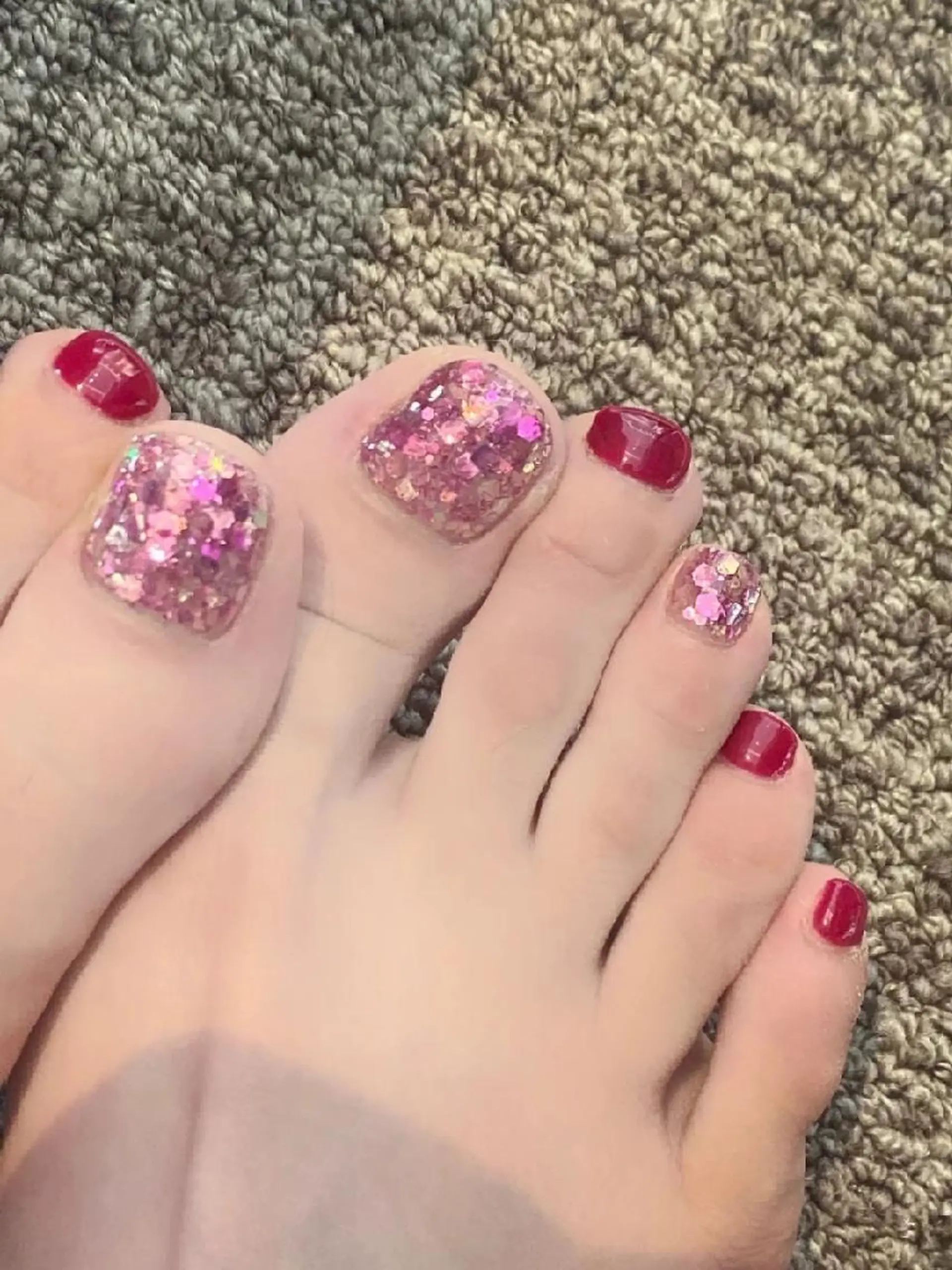 ネイル フットネイル ネイリストゆか💅 長さだし、深爪矯正のネイルデザイン