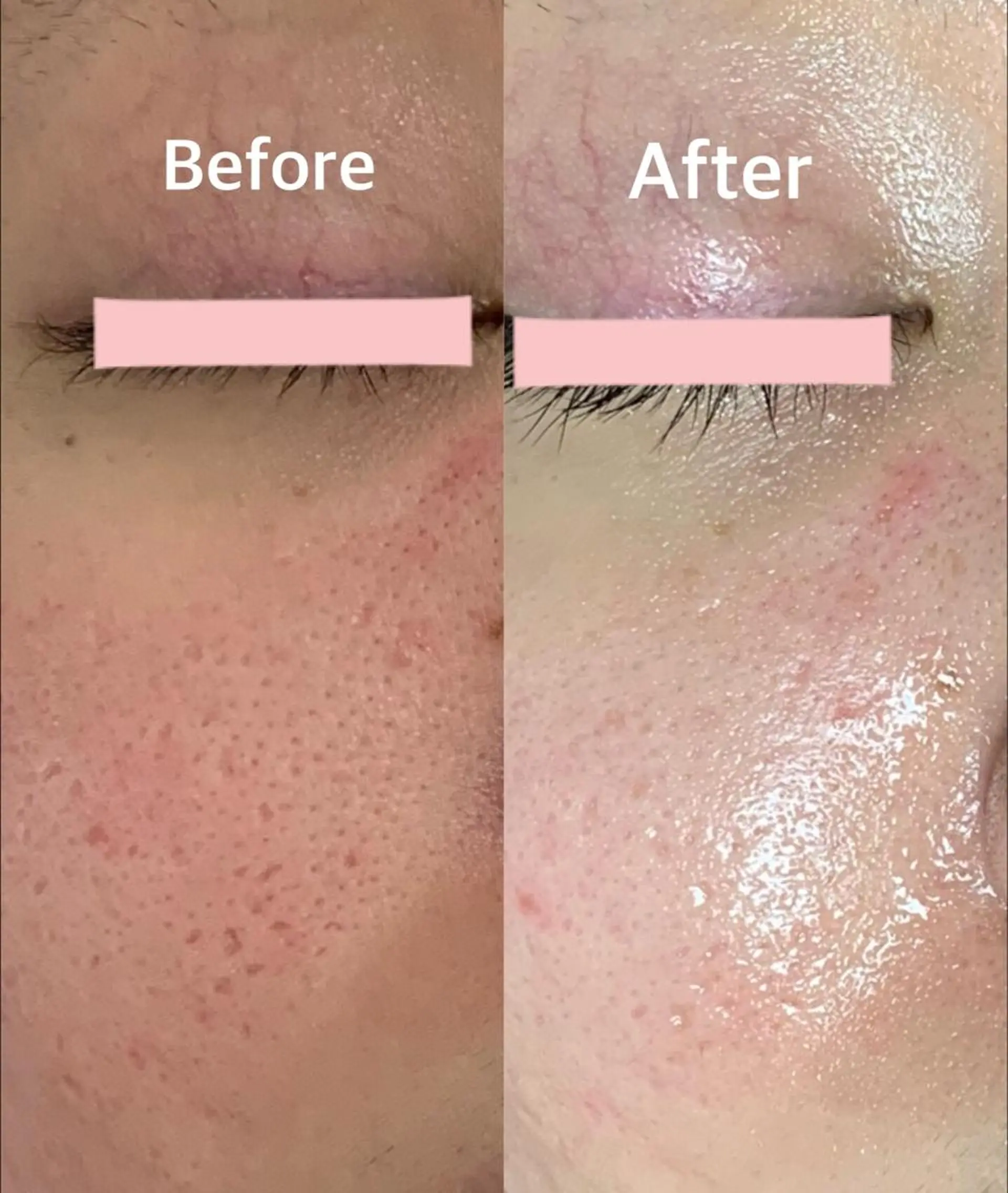 レイビス盛岡店 ♡吉田♡のエステ・リラクイメージ