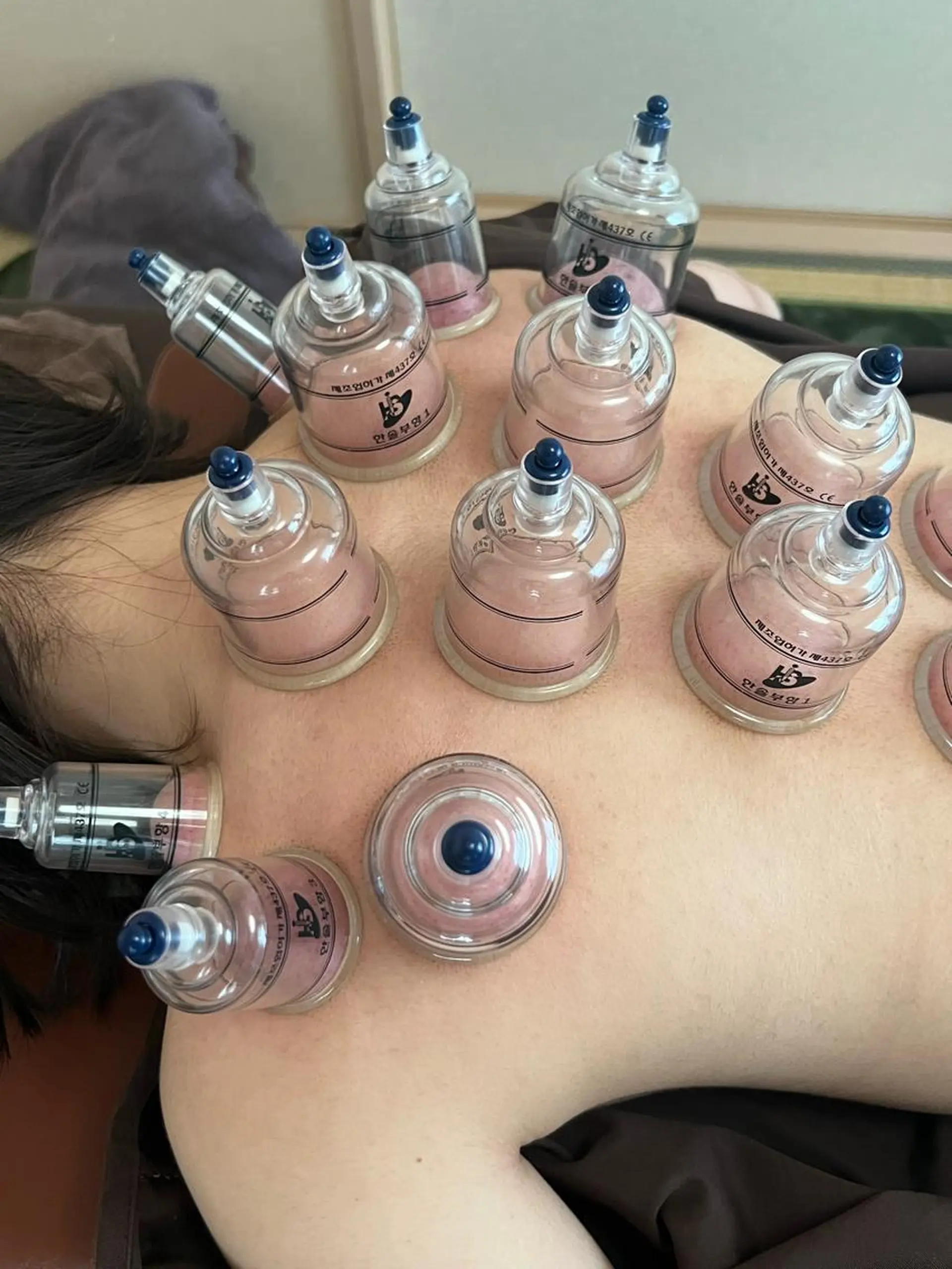 鍼処　木蓮所属・小顔美肌クリエーター 鍼処木蓮のエステ・リラクイメージ