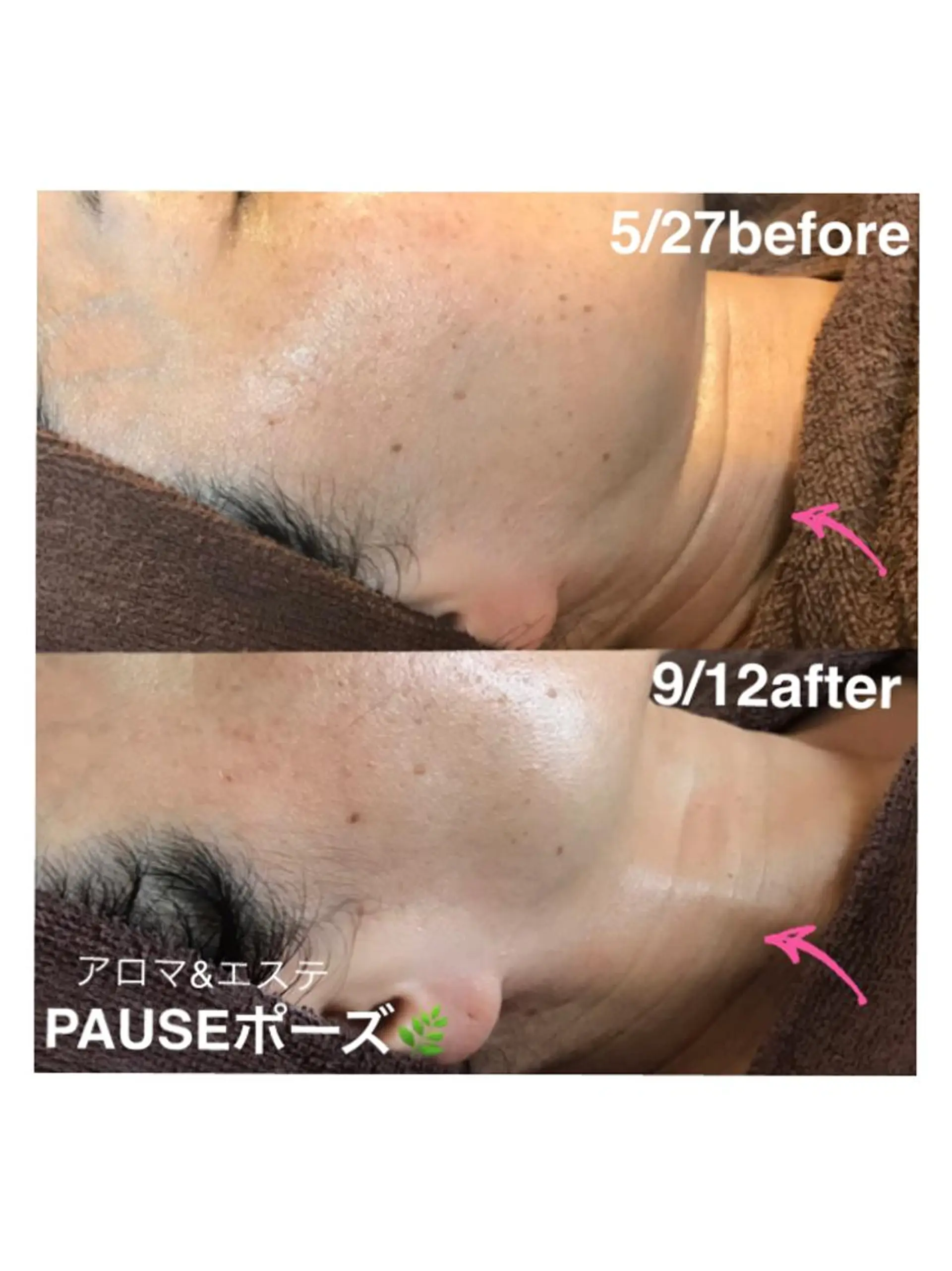 エステ 浜野 恵美のエステ・リラクイメージ