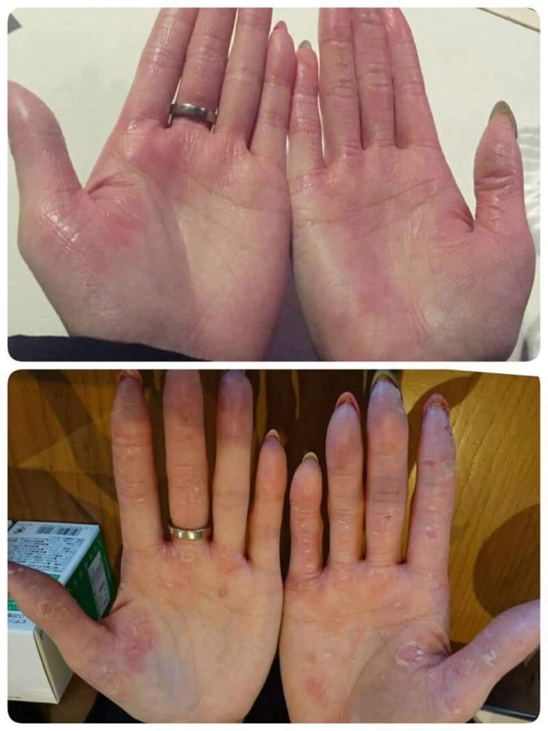 🏳️‍🌈 CHIYAKAのエステ・リラクイメージ