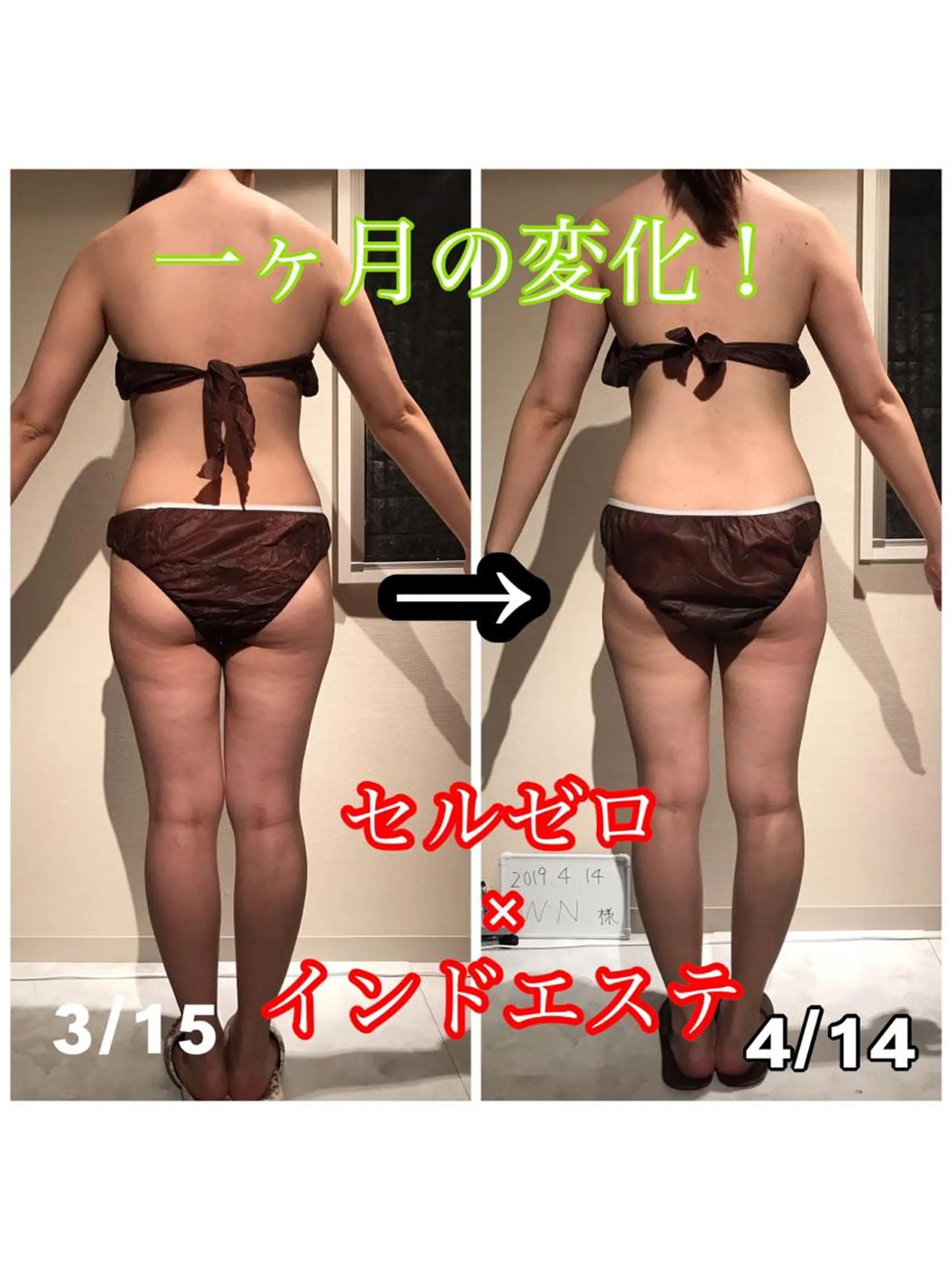 Cielo(シエロ) ダイエット専門店のエステ・リラクイメージ