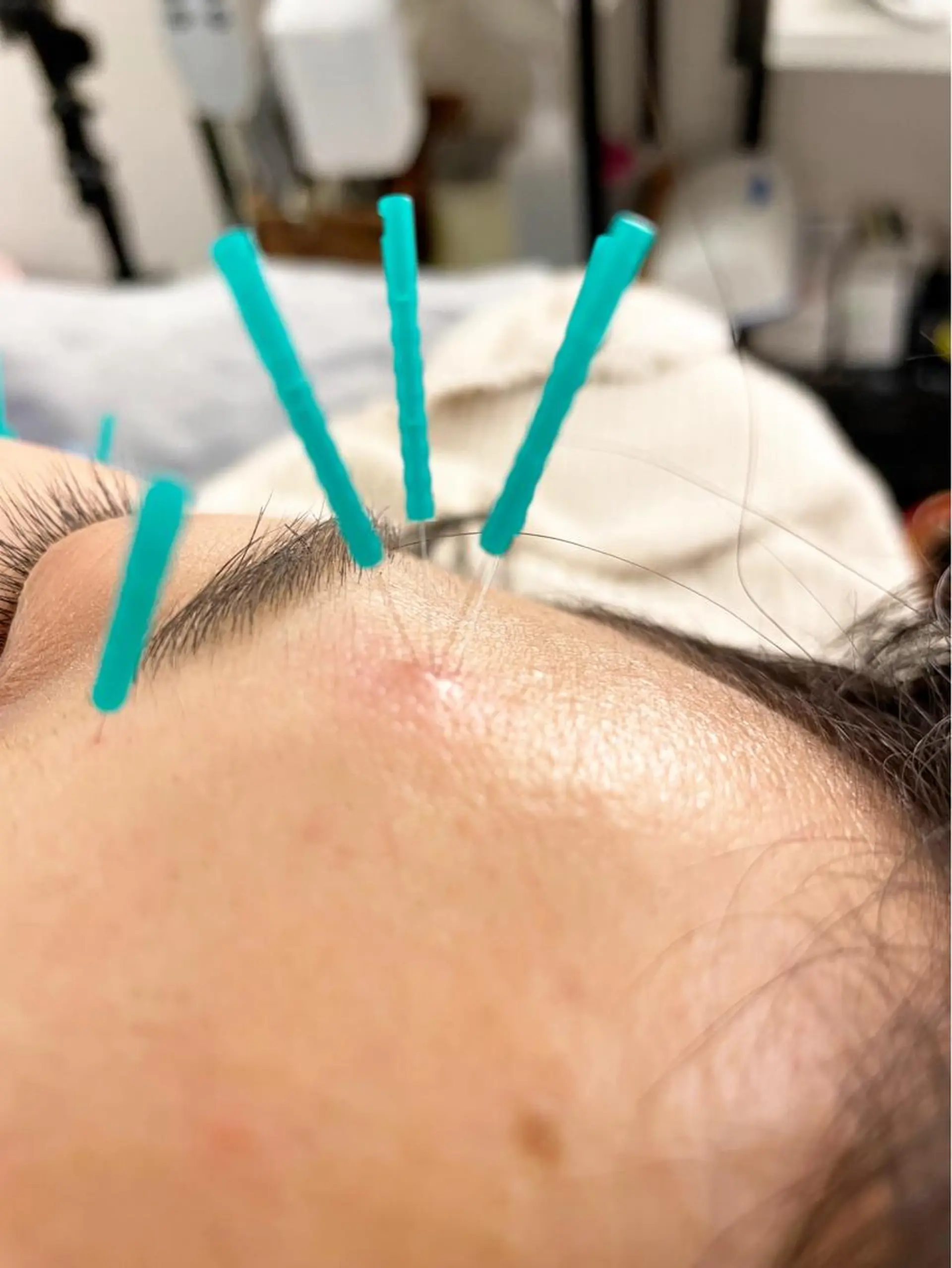 エステ リラク 小顔美容鍼専門サロン 渋谷YZのその他イメージ