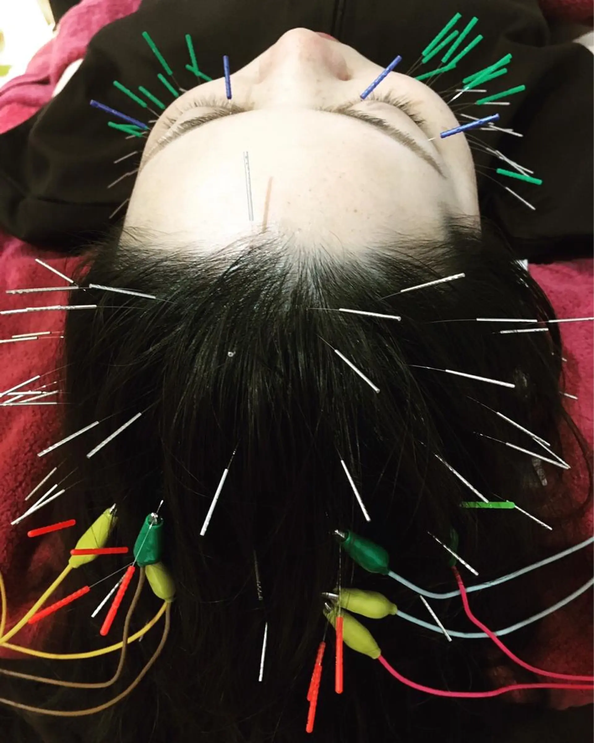 エステ リラク 美容鍼灸女性専用 りんご鍼灸治療院のその他イメージ