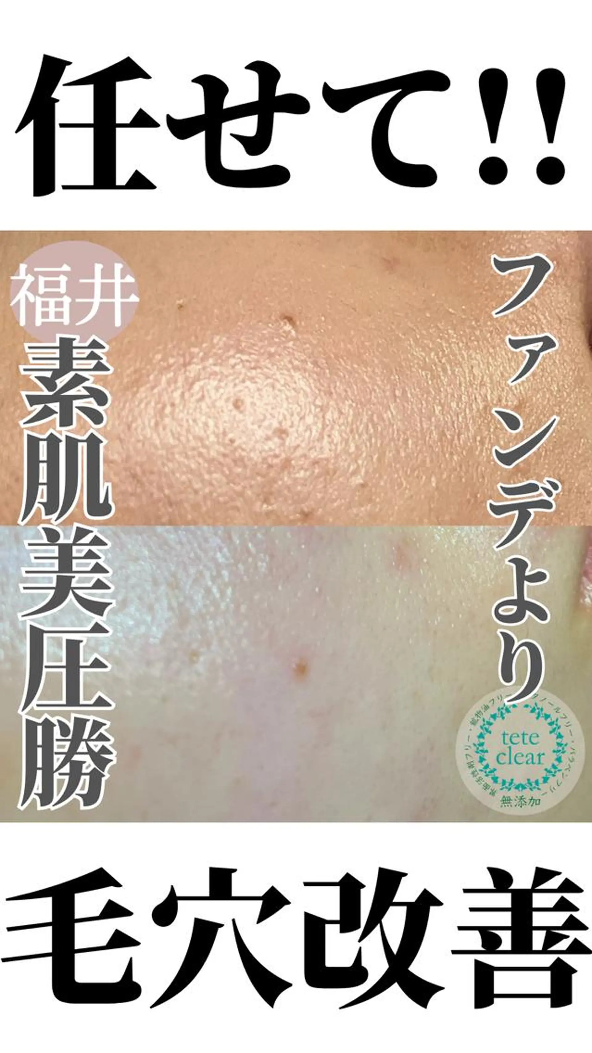 毛穴肌質ケアサロン Yourmeユアミーのエステ・リラクイメージ