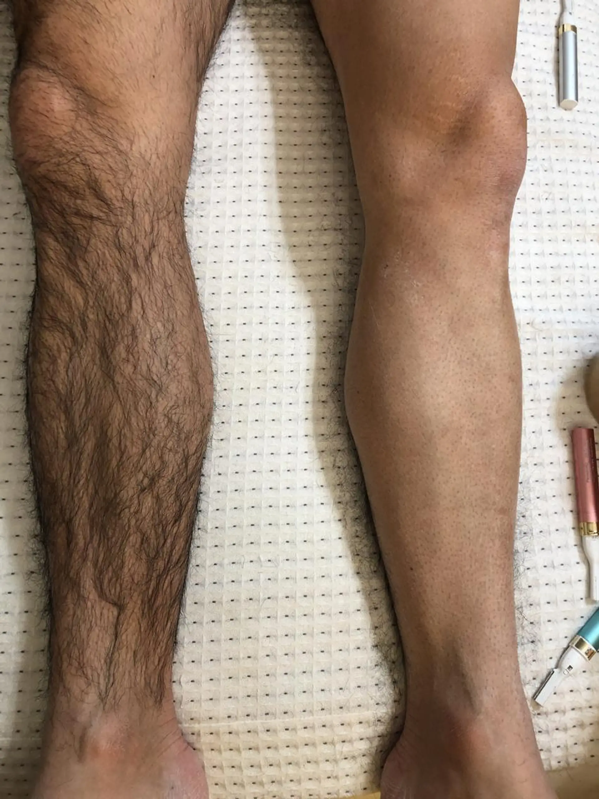 脱毛 ブランエミュ 池袋本店のエステ・リラクイメージ