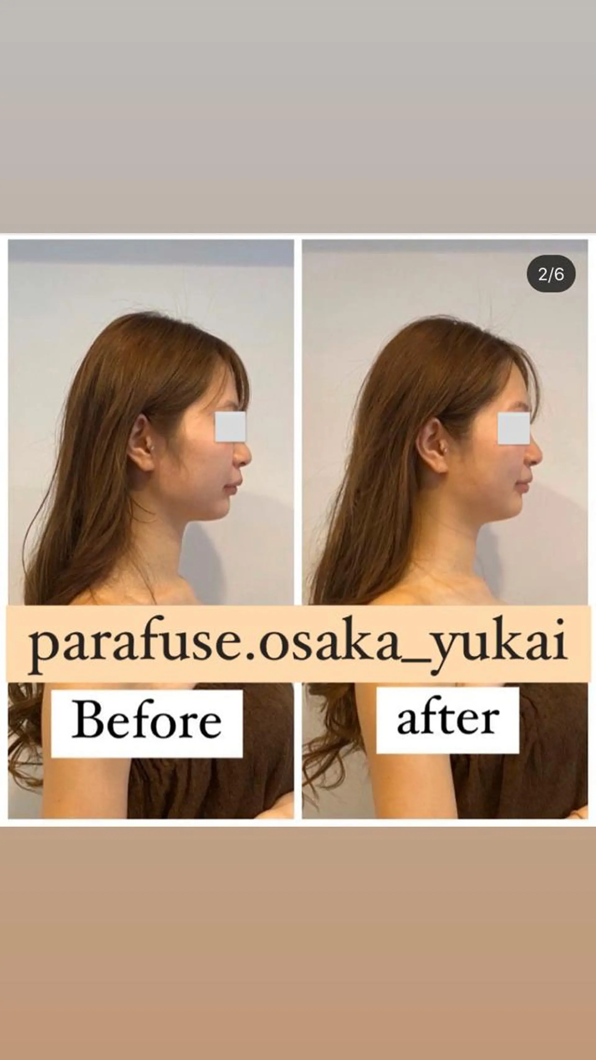 脳洗浄と よもぎ蒸し　Uki.のその他イメージ