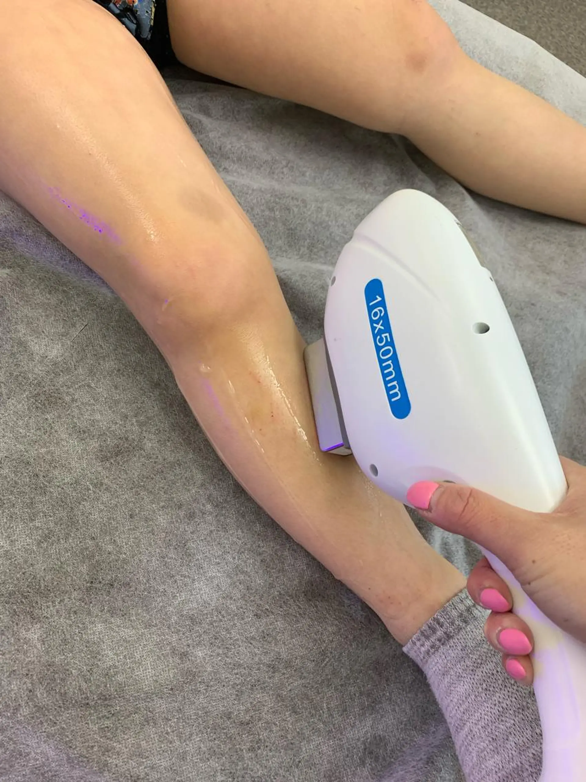 キッズ 脱毛 脱毛サロン NR エヌアール所属・NR Nara yukiのエステ・リラクイメージ