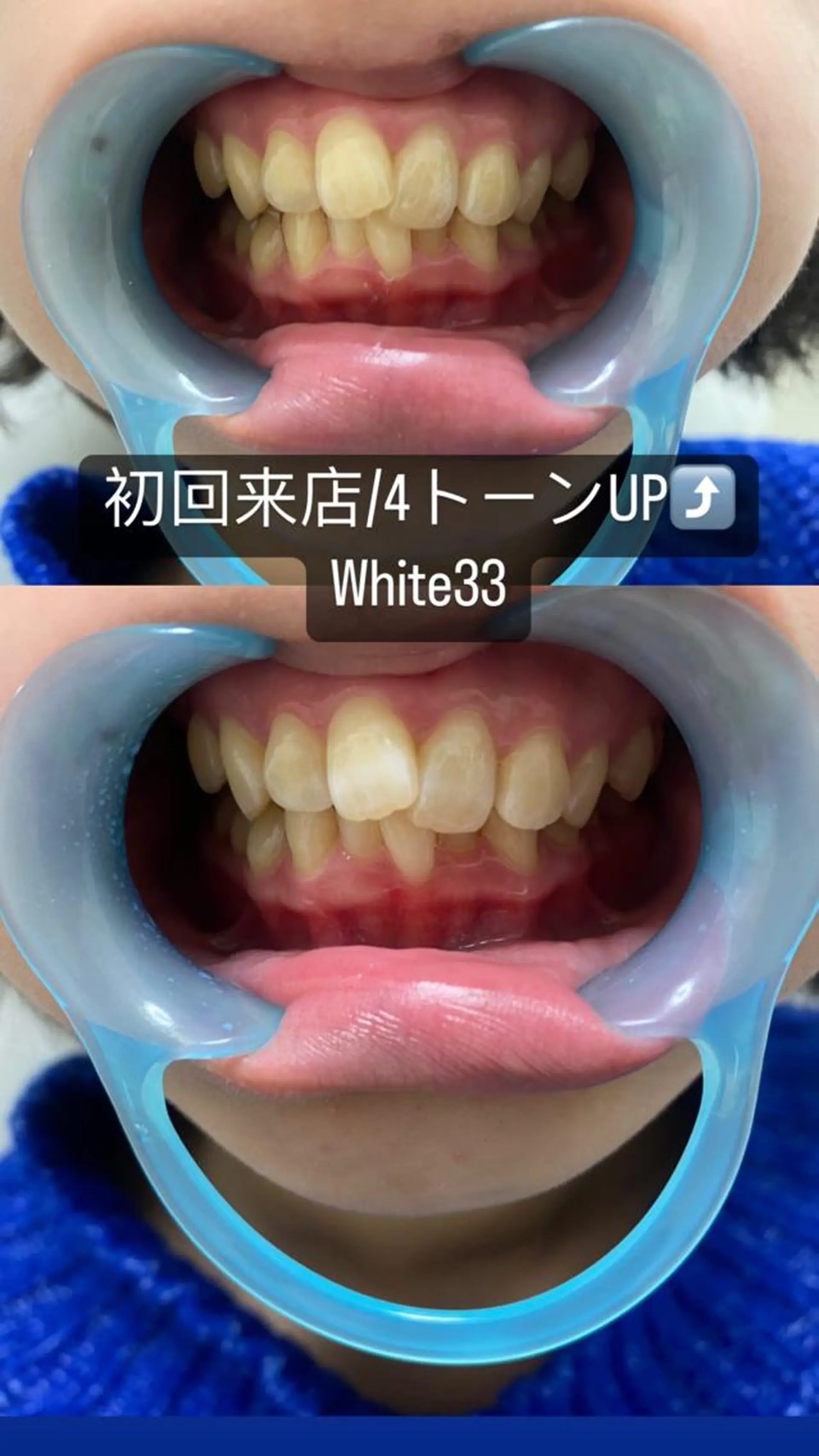 メンズ セルフホワイトニング White33大名のその他イメージ