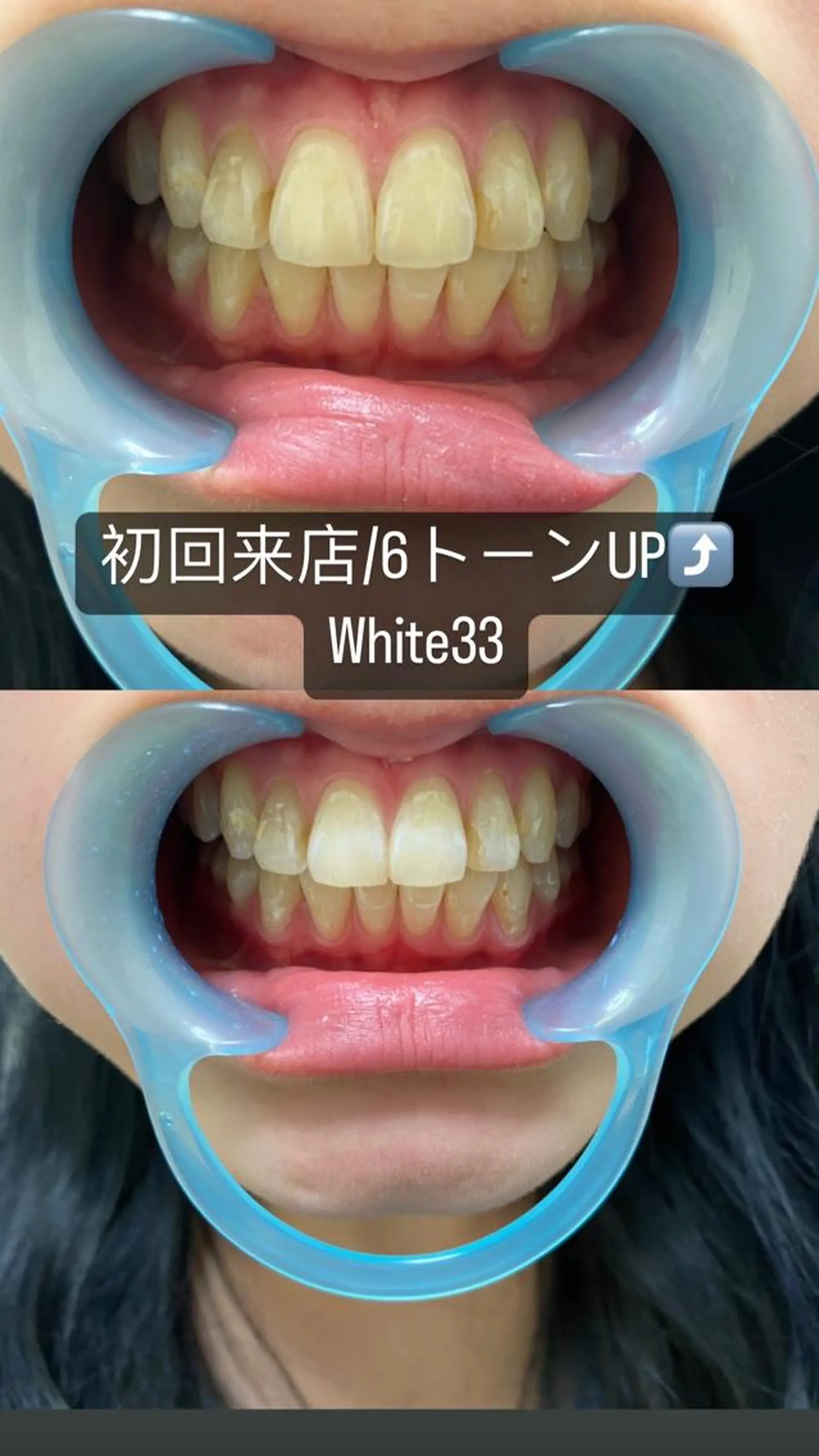 メンズ セルフホワイトニング White33大名のその他イメージ