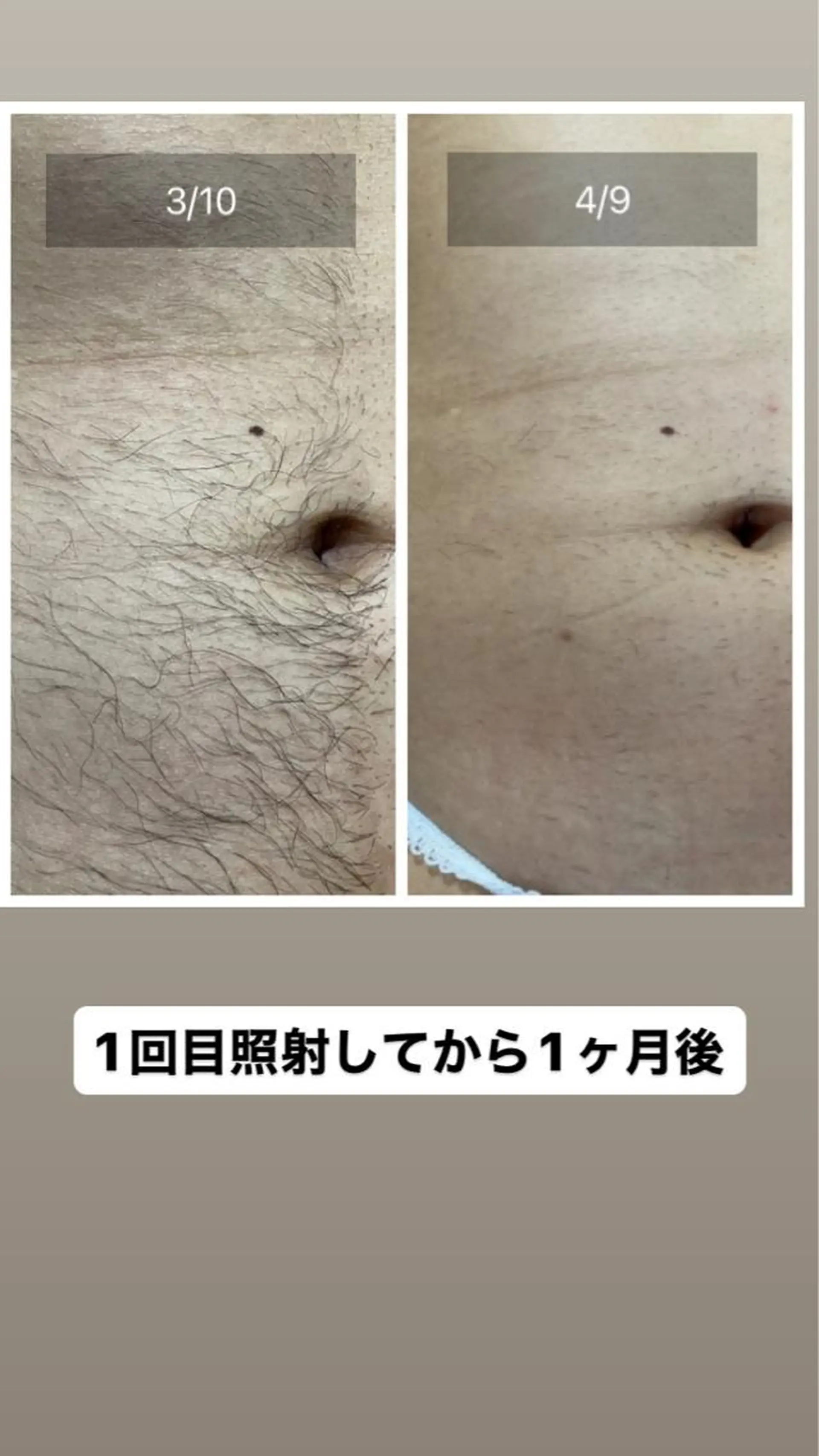 メンズ salon rosariumのエステ・リラクイメージ