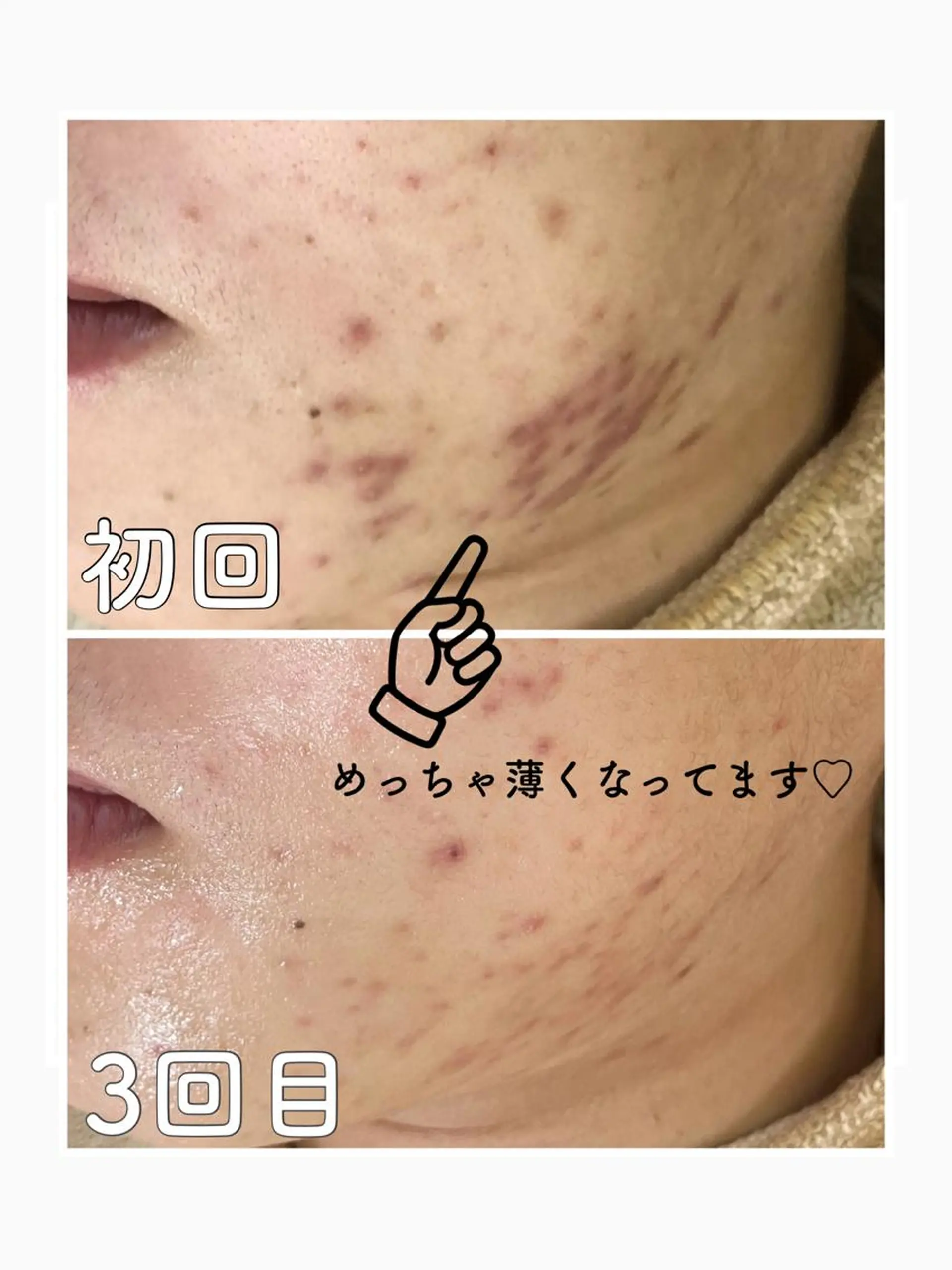 ロング カラー パーマ ヘアアレンジ メンズ キッズ ネイル マツエク・マツパ エステ ニキビ&跡改善サロン オーナー光木のエステ・リラクイメージ