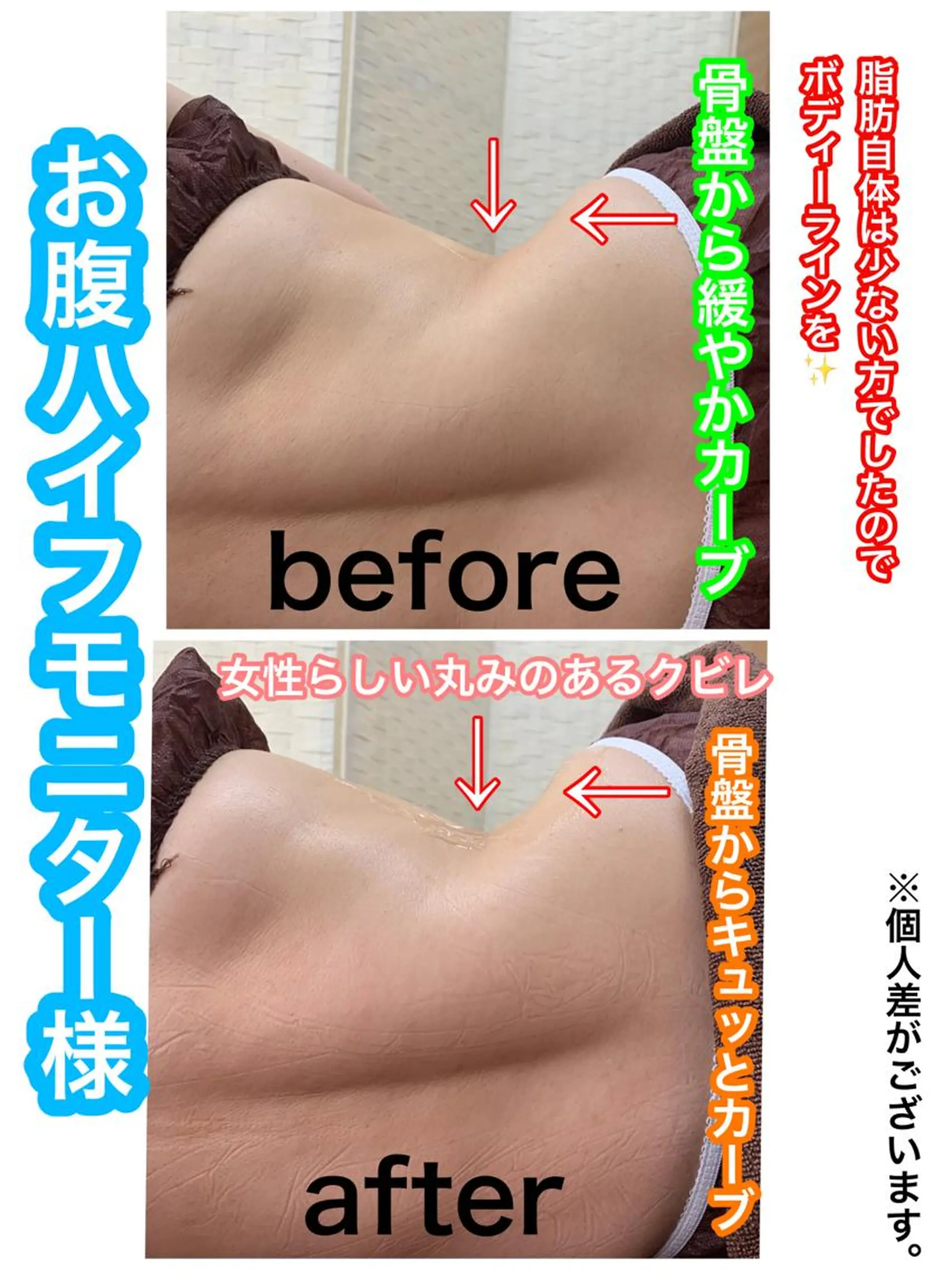 痩身/脱毛/ネイル HARUKAのエステ・リラクイメージ