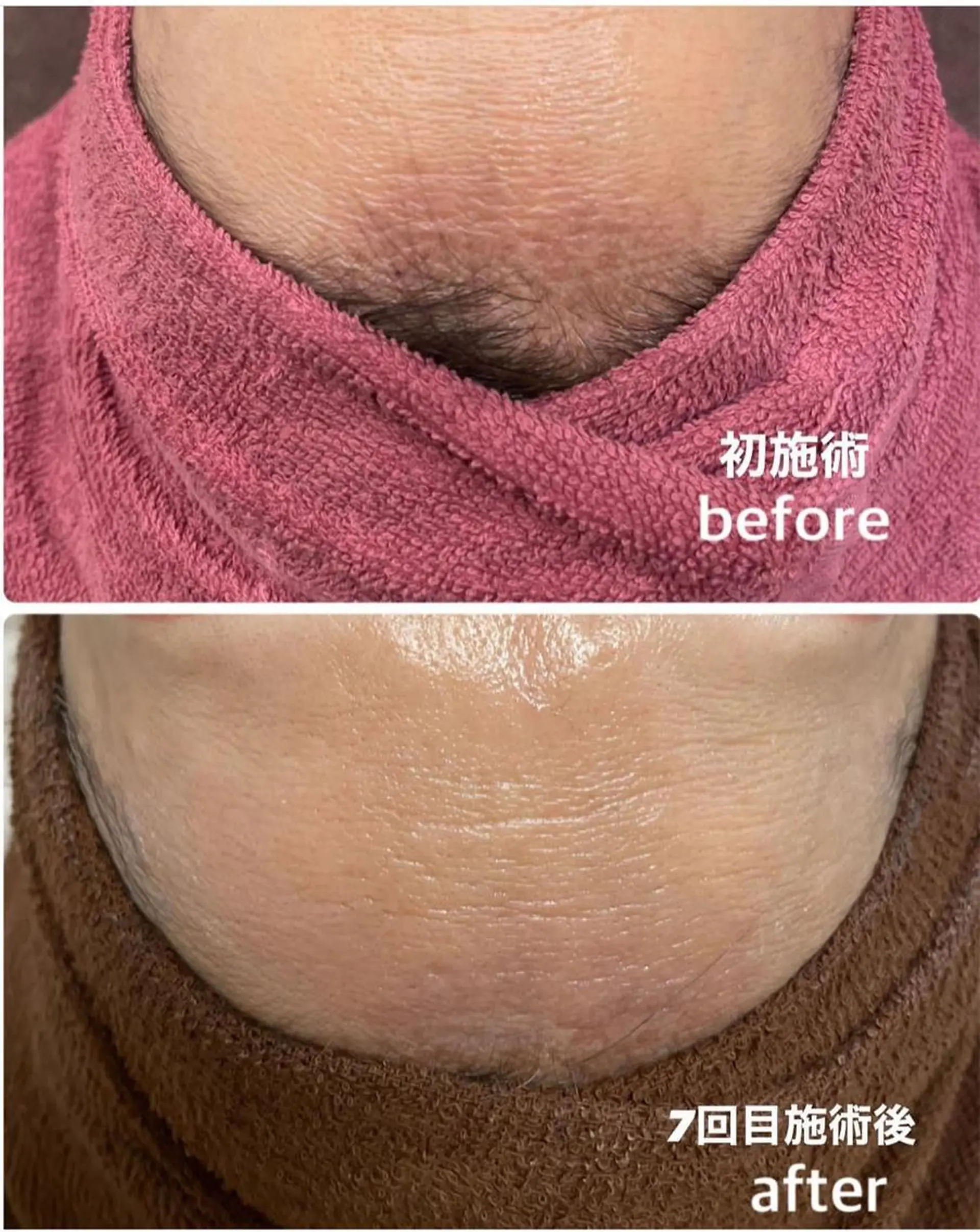 エステ リラク ビューティーサロン Claireのエステ・リラクイメージ