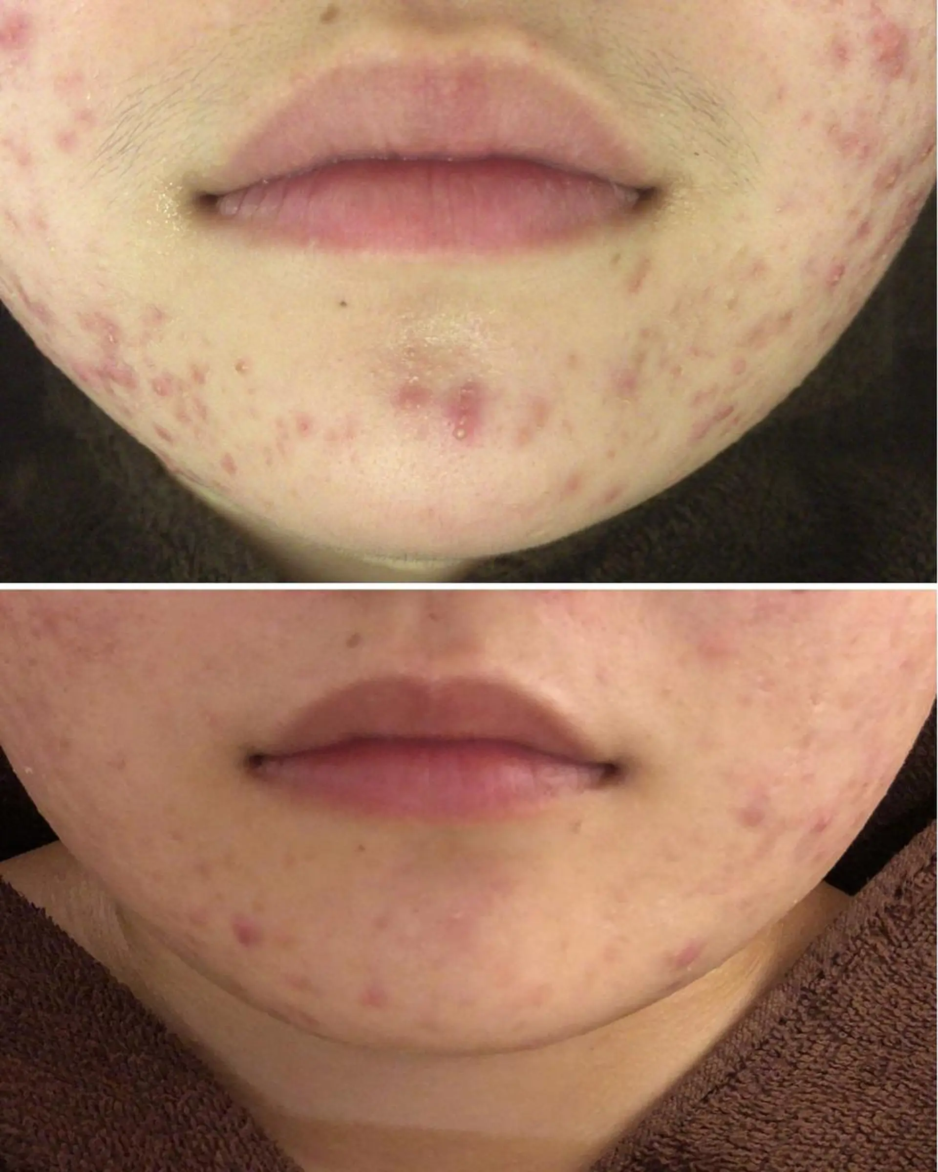 ミディアム カラー パーマ ヘアアレンジ メンズ キッズ ネイル マツエク・マツパ エステ リラク ニキビ・肌質改善専門 ♡人生が変わるサロンのエステ・リラクイメージ