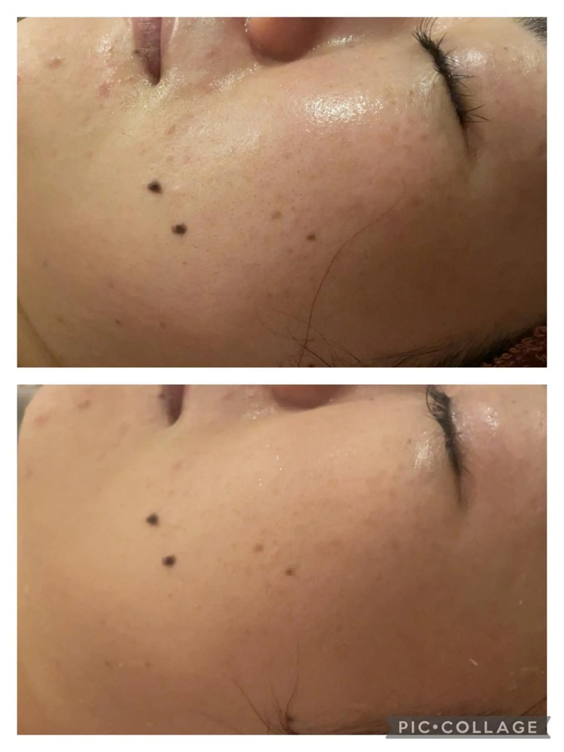 セミロング カラー パーマ ヘアアレンジ メンズ キッズ ネイル マツエク・マツパ アイブロウ 🔥3か月で肌革命 🔥ニキビ専門店のエステ・リラクイメージ