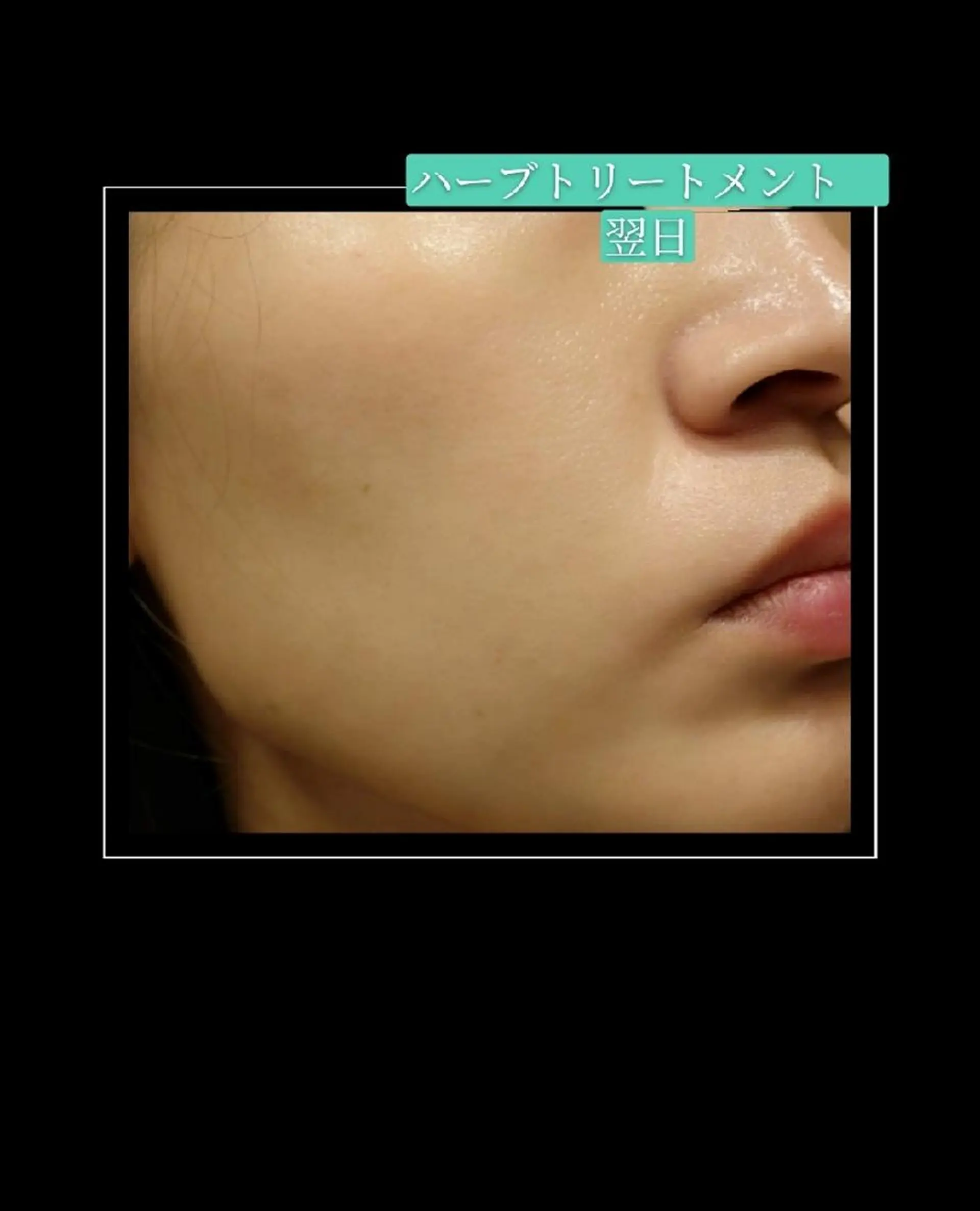 🅖🅤🅩🅔🅛 salonのエステ・リラクイメージ