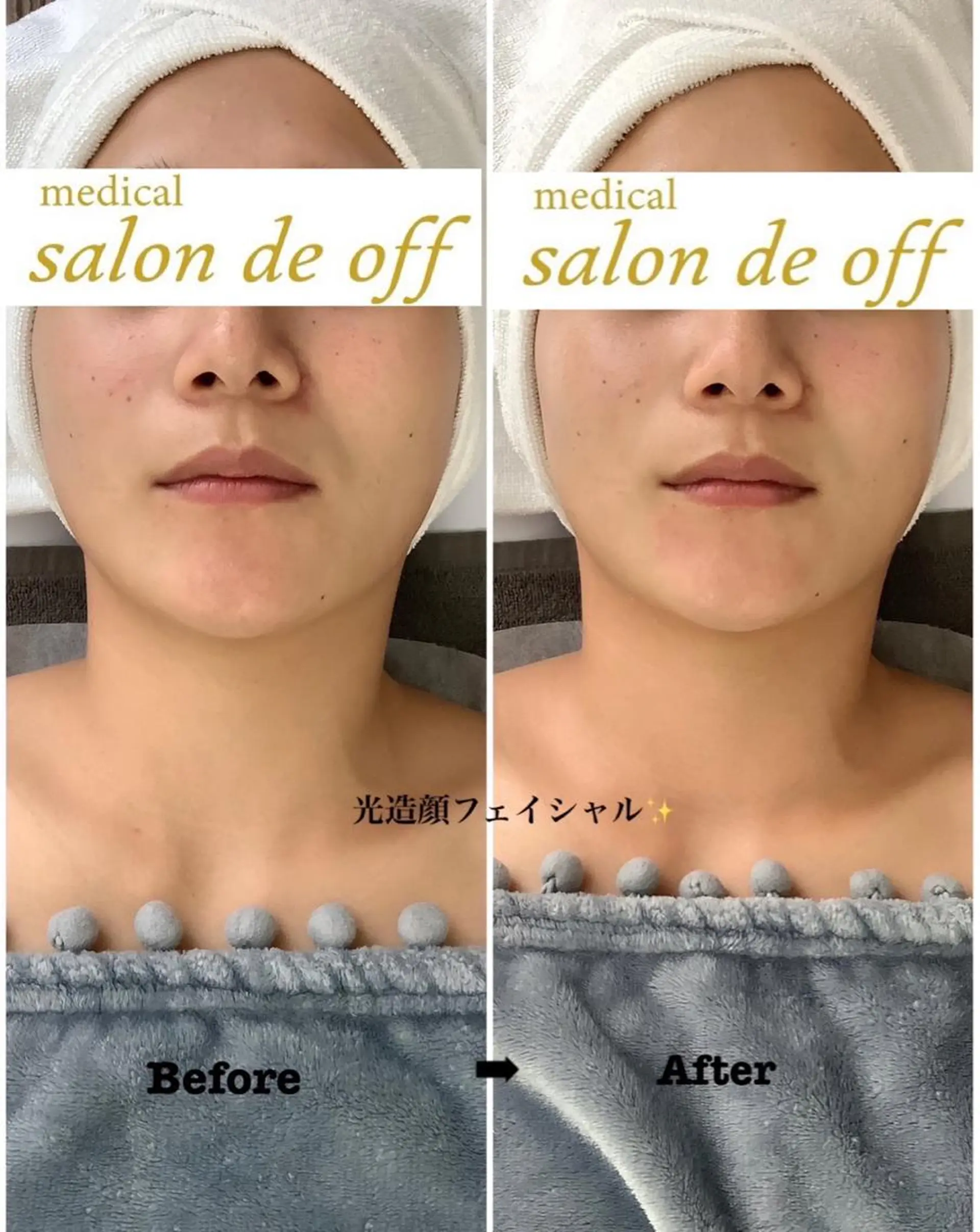 🩵Tatsumi Kana🩵のエステ・リラクイメージ