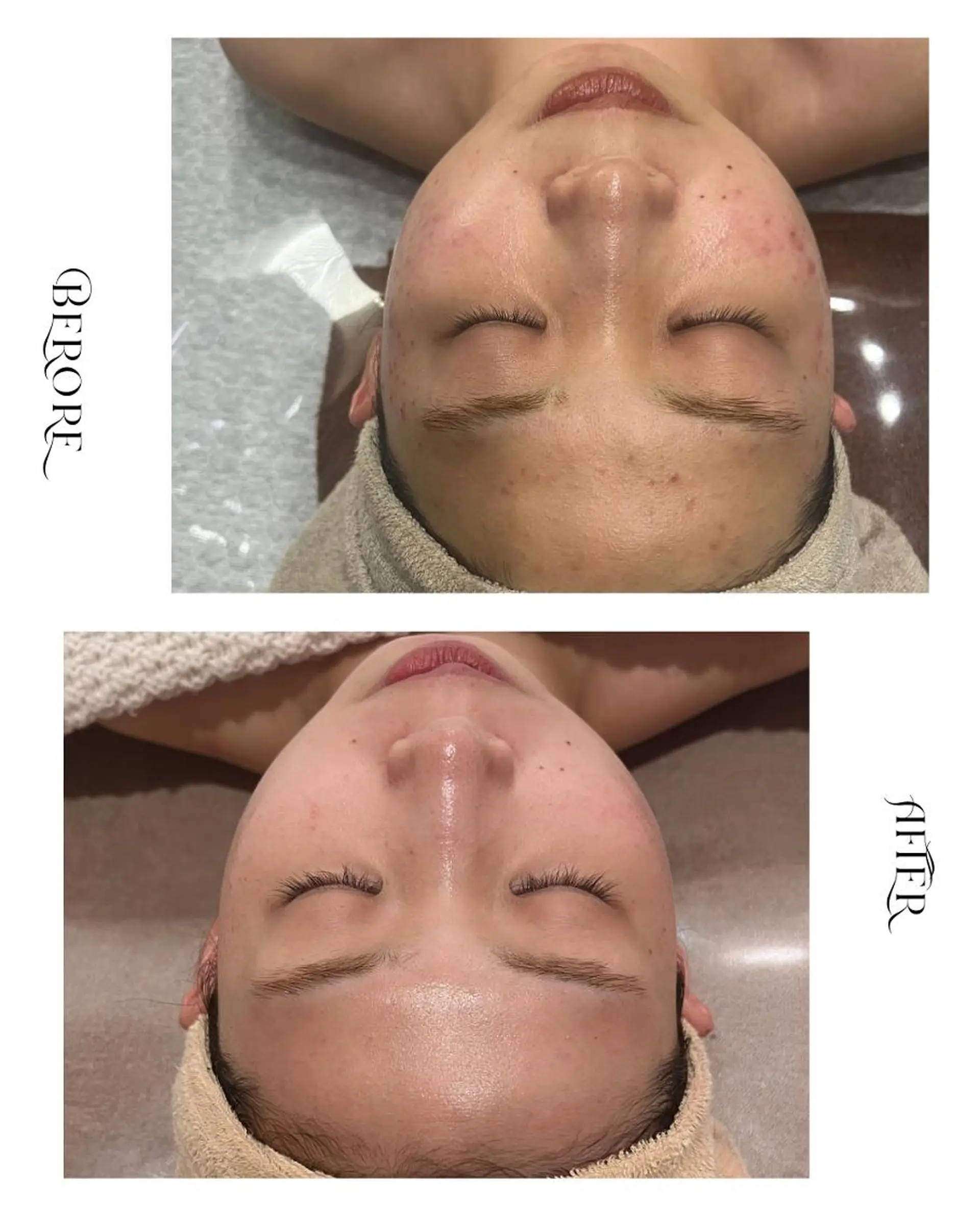 脱毛・肌質改善サロン Linoのエステ・リラクイメージ