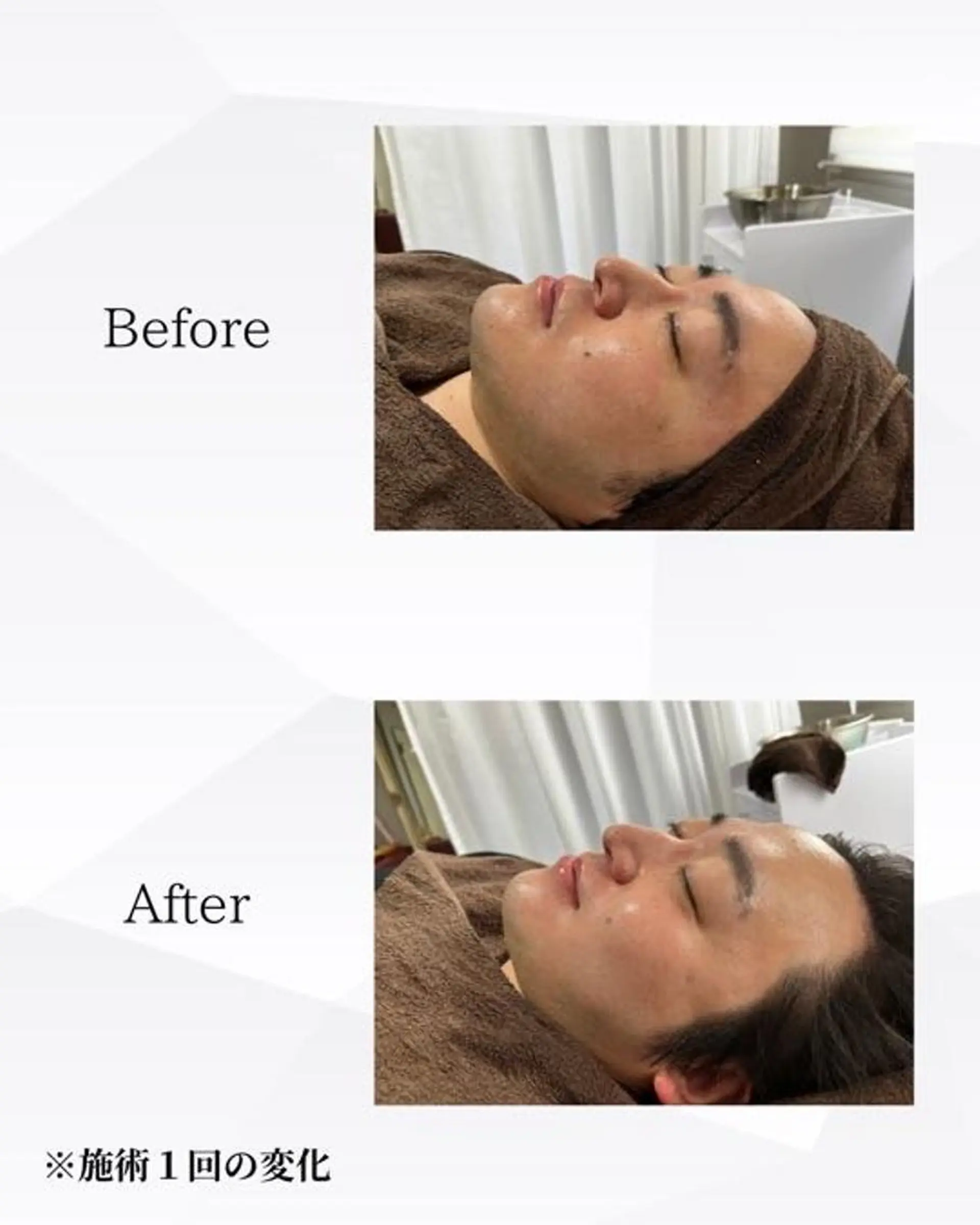 ハーブピーリング🌿 REVI/Ayanoのエステ・リラクイメージ