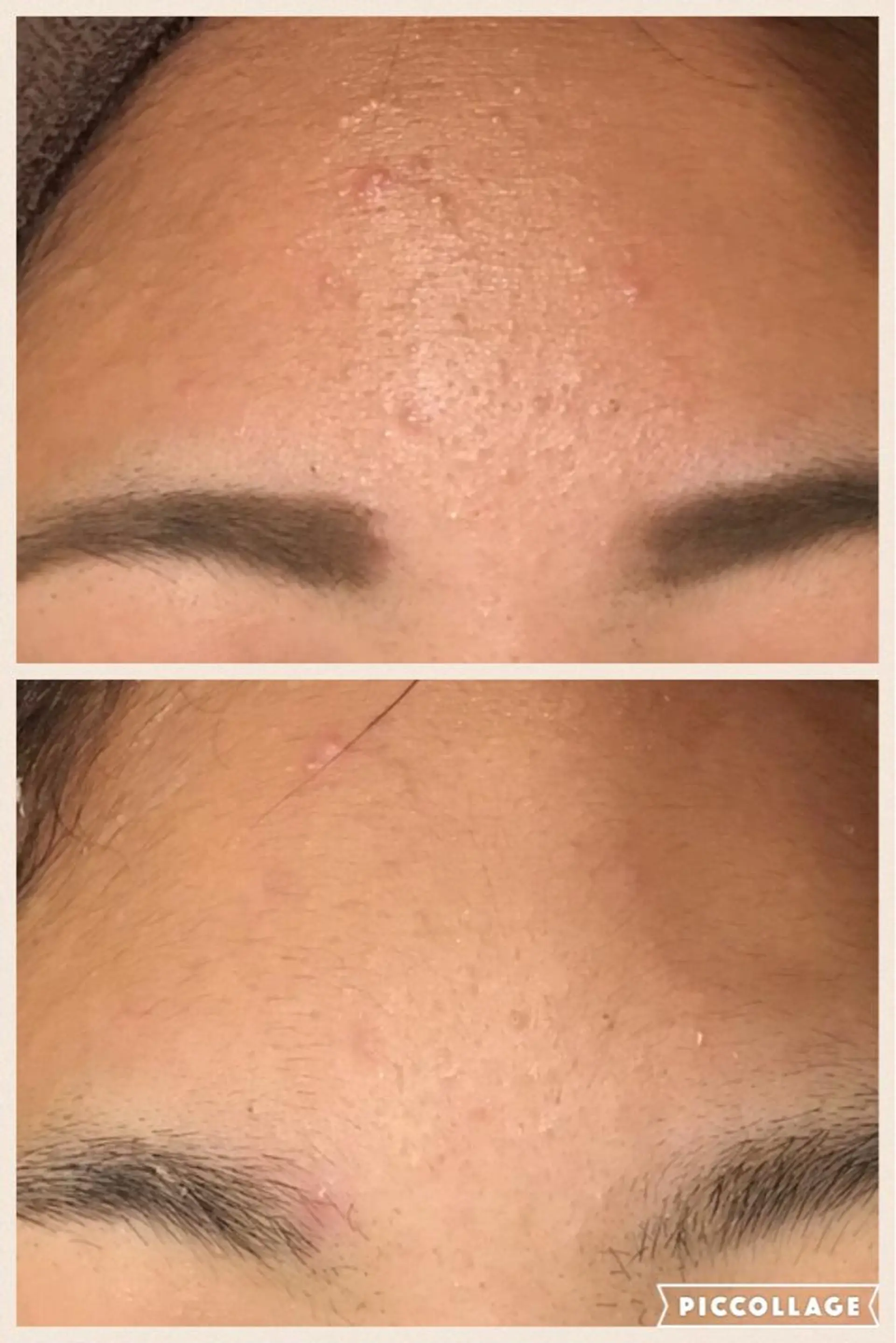 メンズ キッズ 四つ星サロン🎖 腸＆ニキビケアに特化のエステ・リラクイメージ