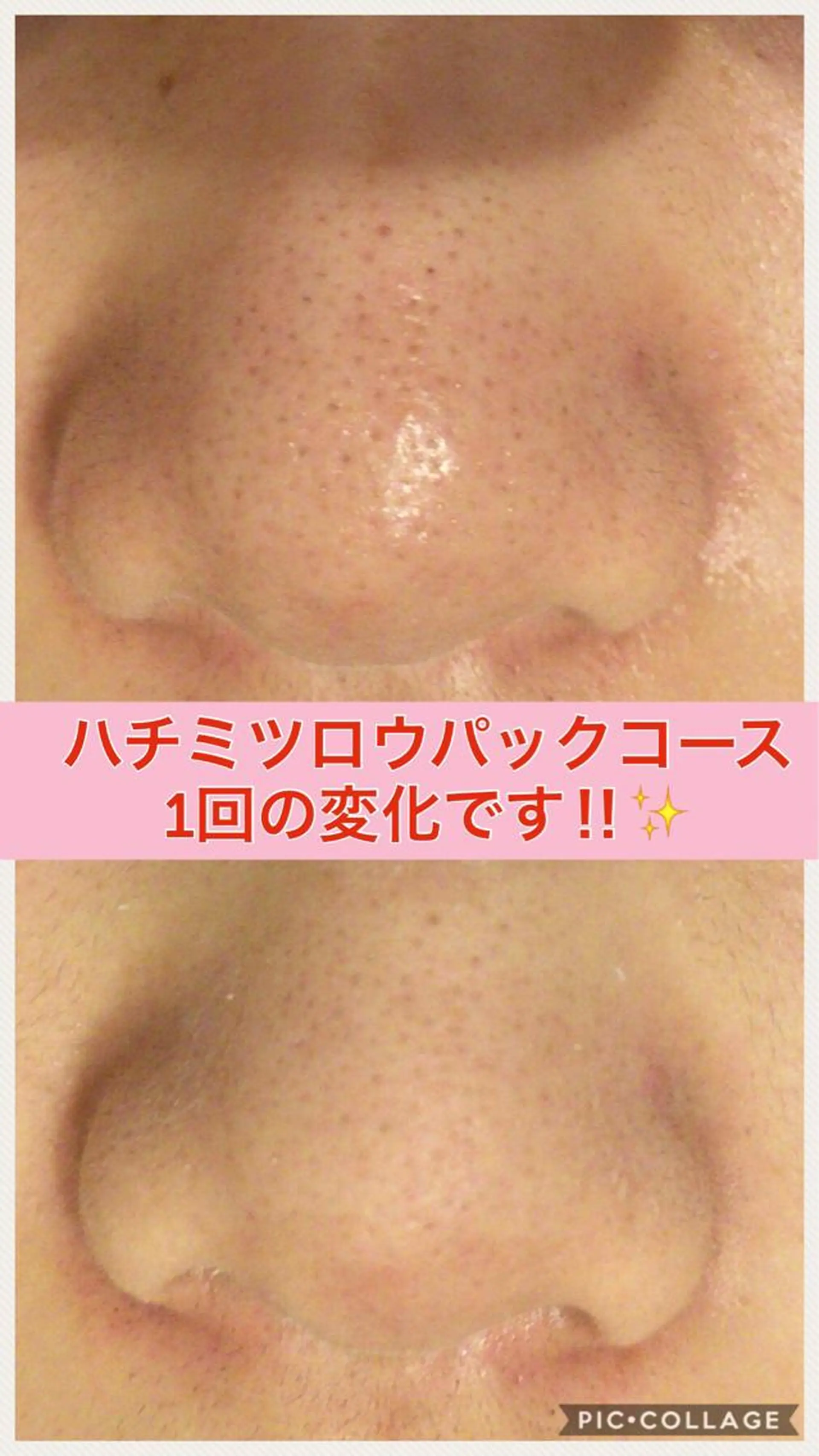 ショート カラー パーマ ヘアアレンジ メンズ キッズ ネイル マツエク・マツパ ニキビ・肌質改善専門 ♡人生が変わるサロンのエステ・リラクイメージ