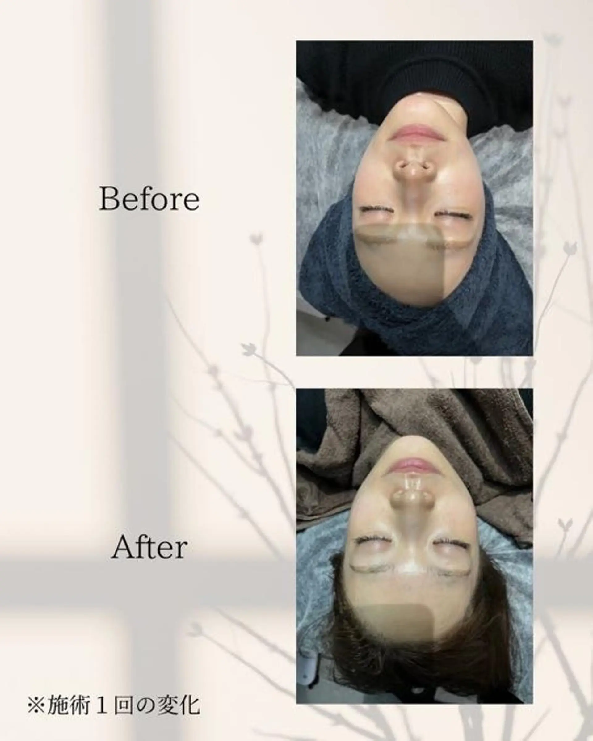 エステ ハーブピーリング🌿 REVI/Ayanoのエステ・リラクイメージ