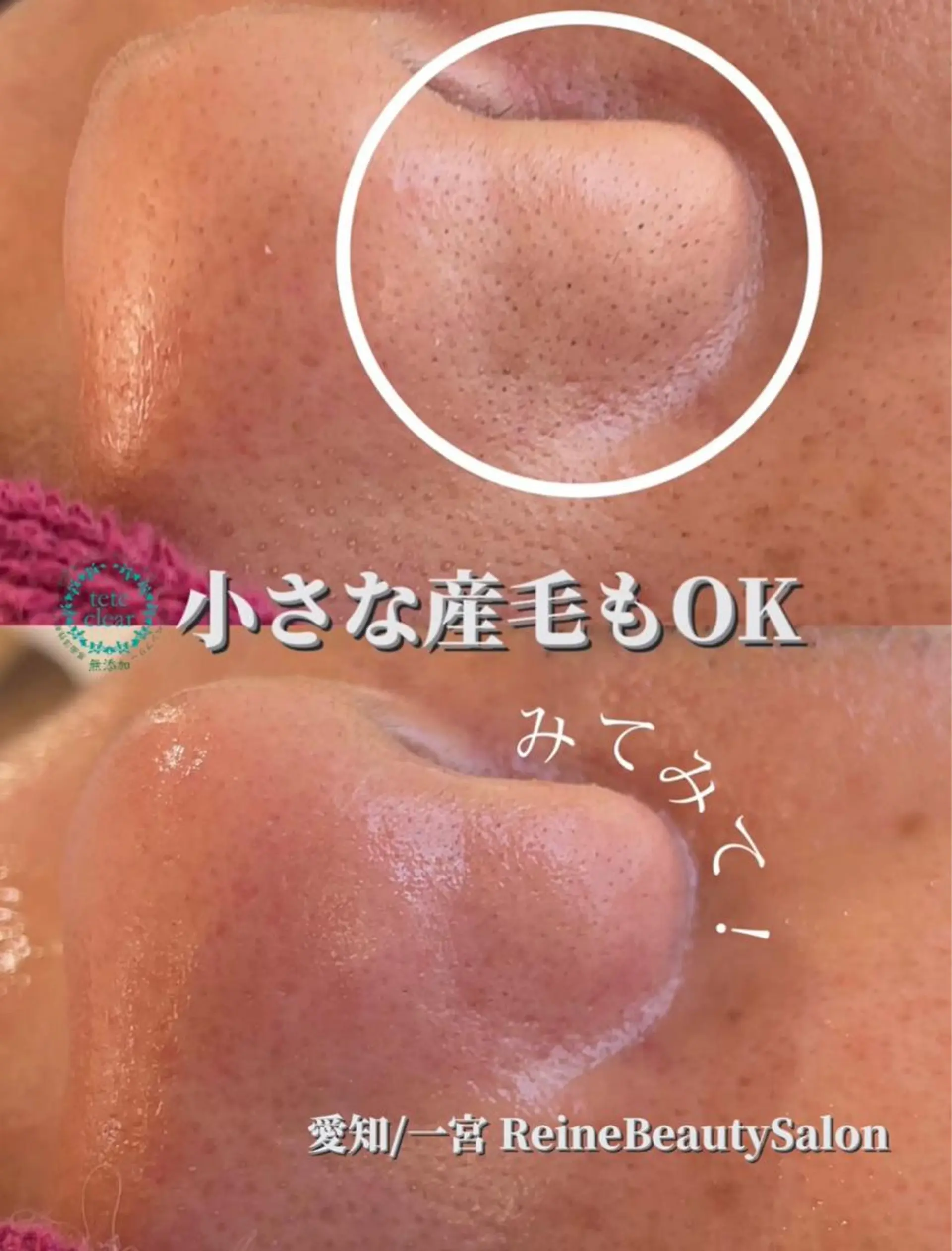 Reine BeautySalon所属・毛穴/シミ肝斑/脱毛 横山梨里のエステ・リラクイメージ