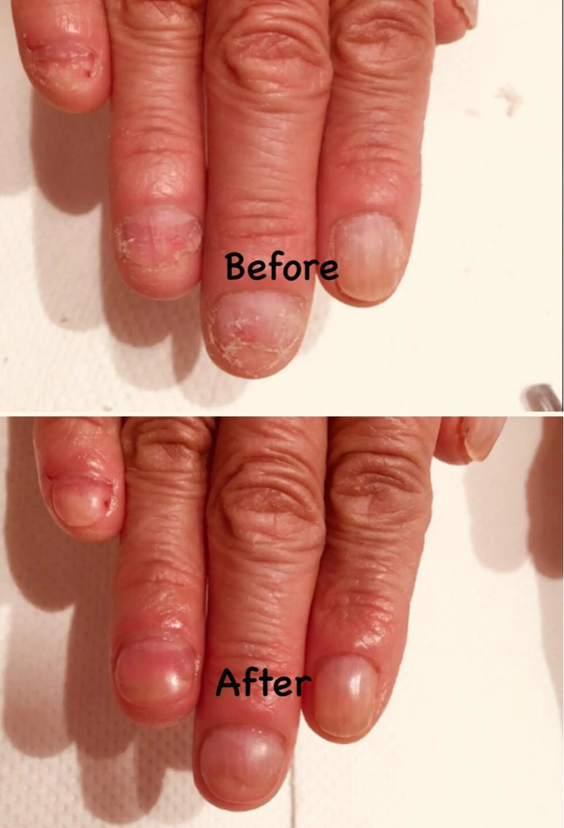 ネイル ハンドネイル 深爪改善 サロンのネイルデザイン