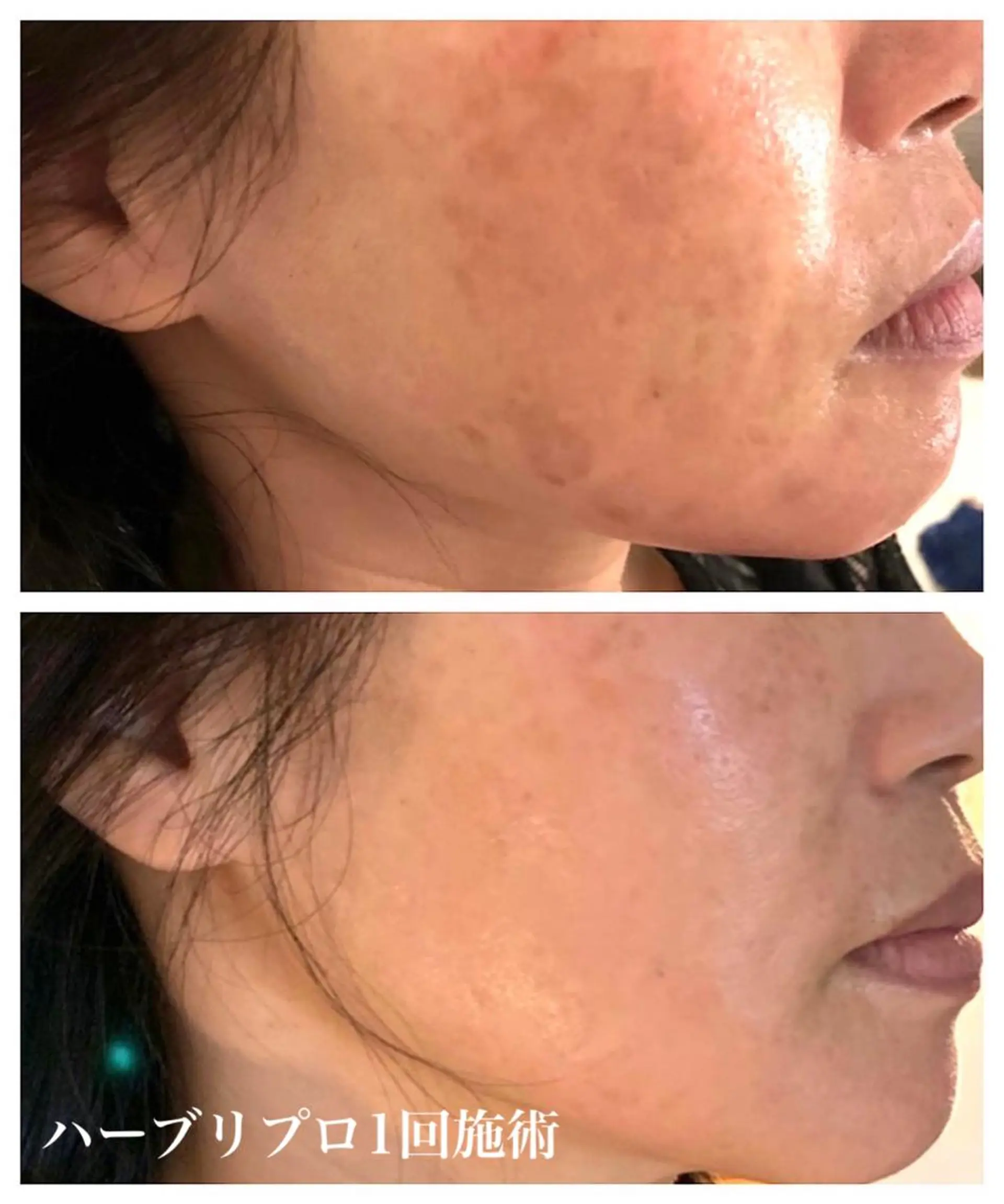 1ヶ月後も半分残る 高持続LEDエクステのマツエク・マツパデザイン