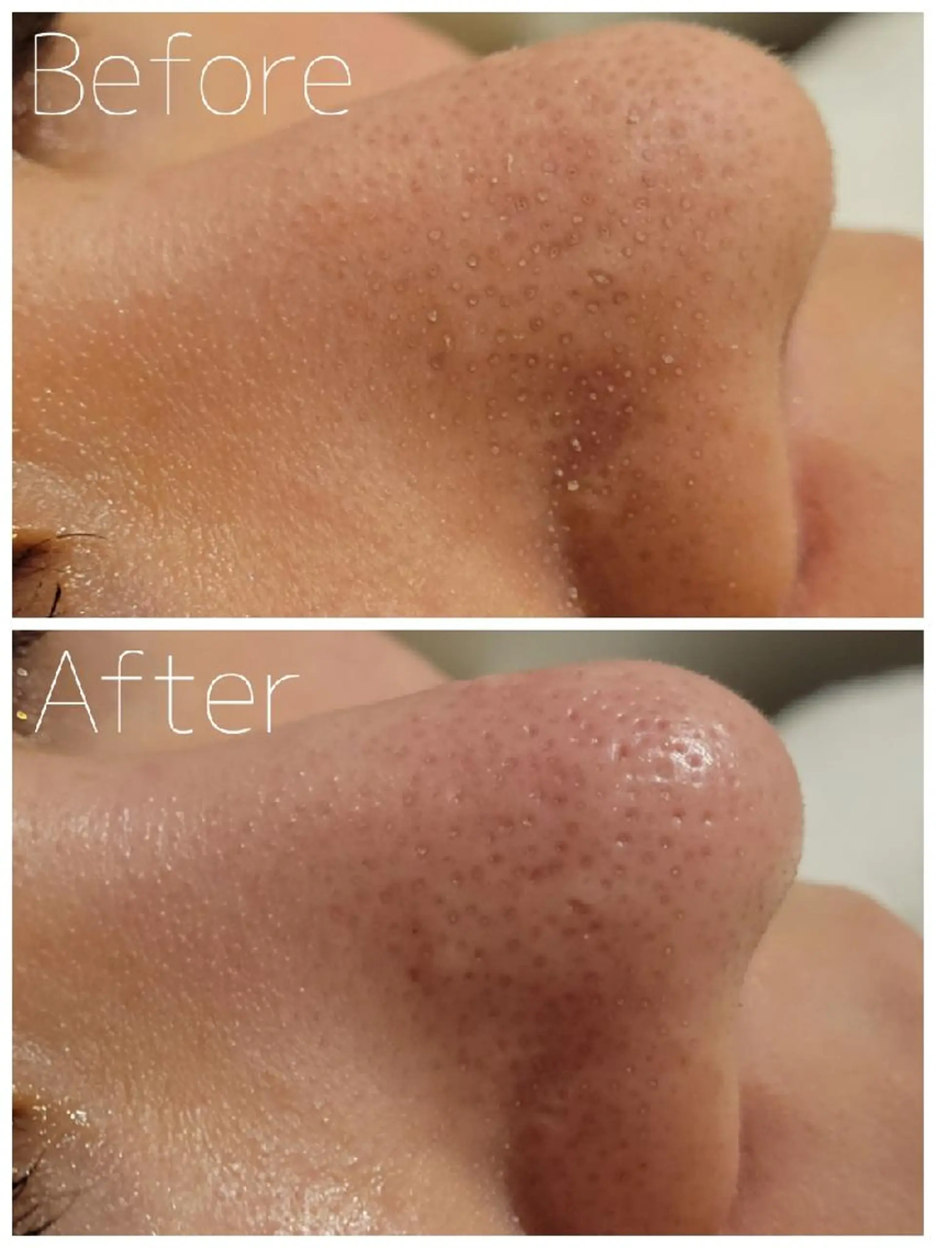 エステ 毛穴/肌管理/痩身/ ボディケア/satoのエステ・リラクイメージ