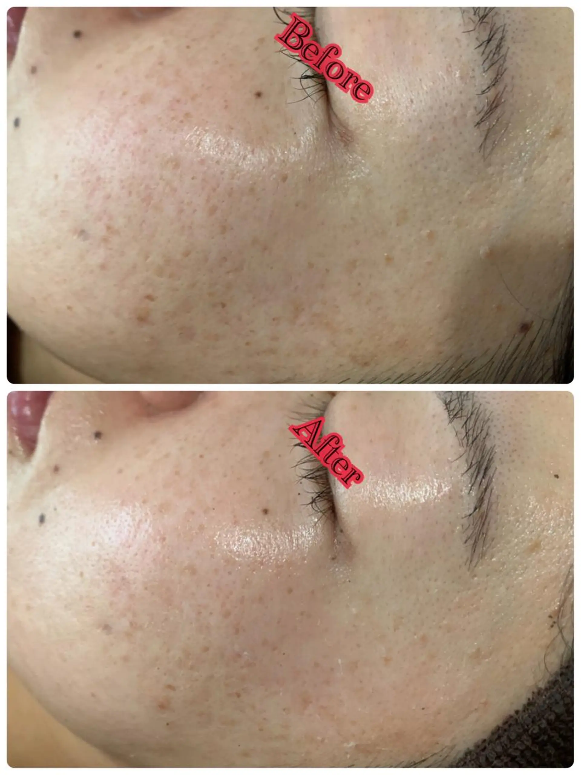 エステ espoir エスポワールのネイルデザイン