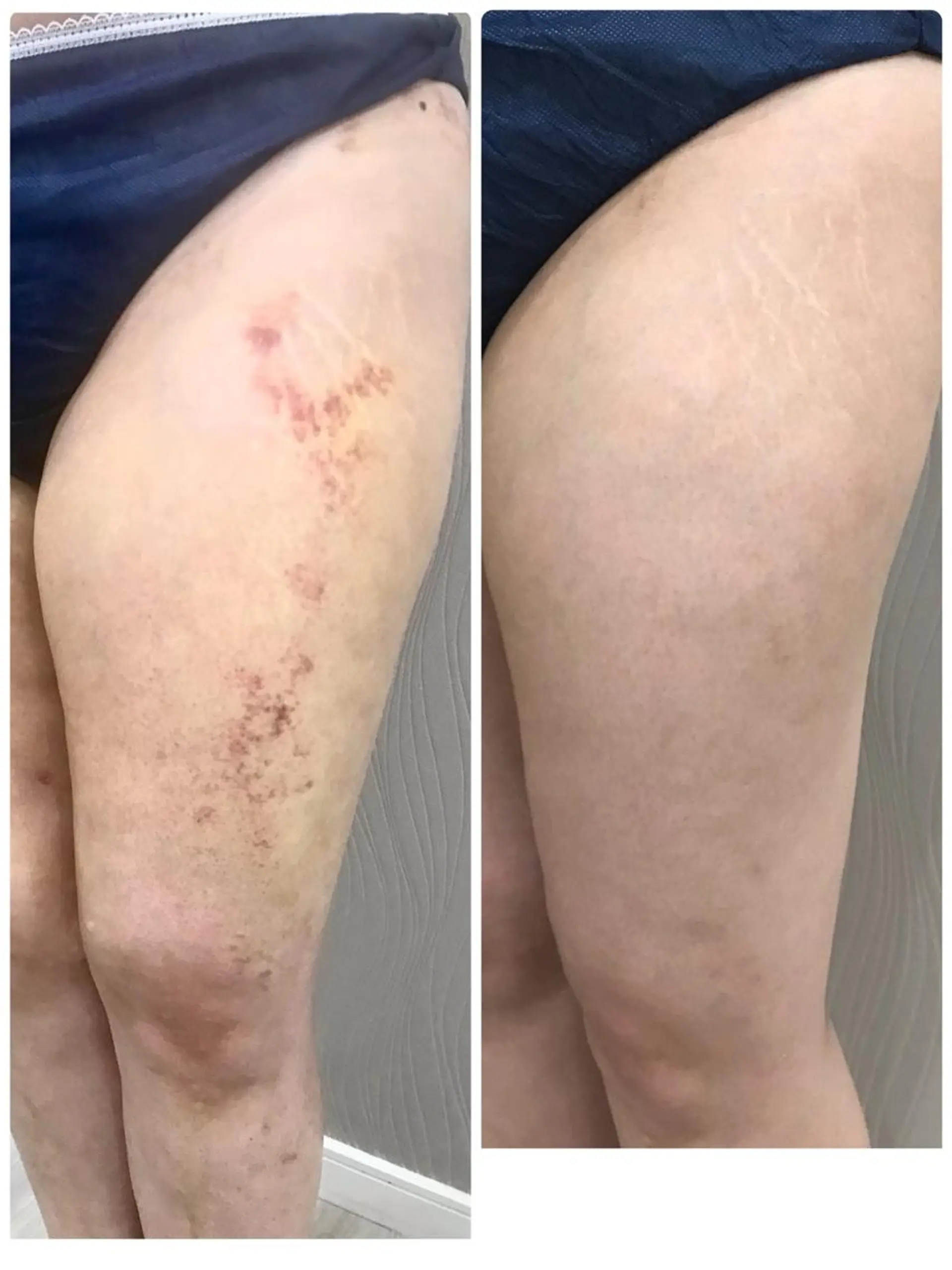 エステティックサロン ベルネのエステ・リラクイメージ