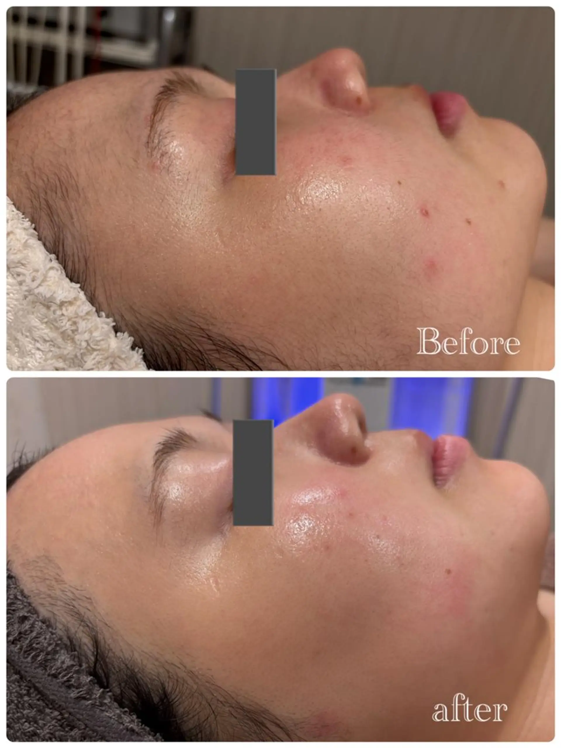 脱毛 痩身脱毛専門店 Partirのエステ・リラクイメージ