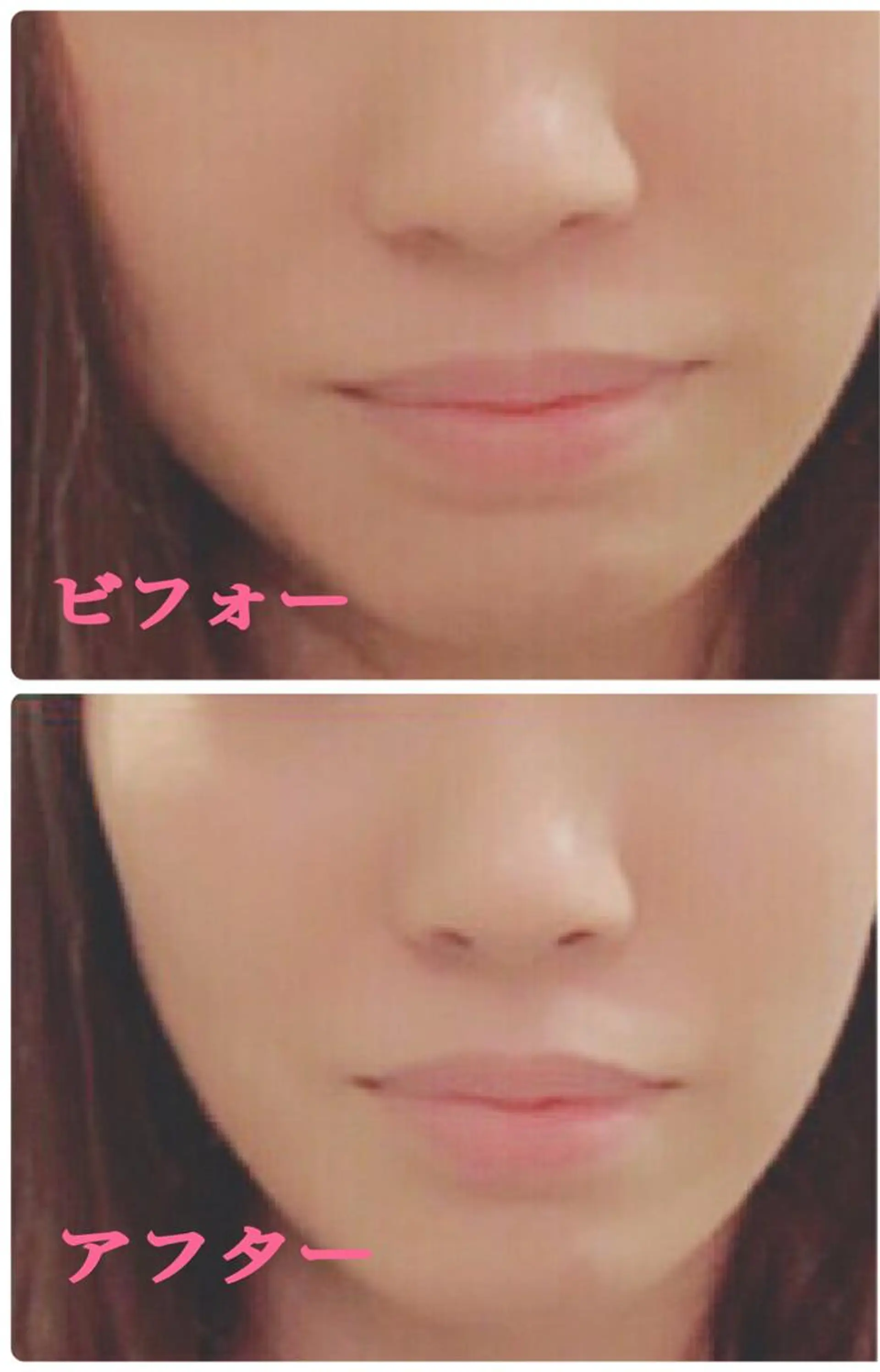 小顔サロン ソ.ルシエのエステ・リラクイメージ