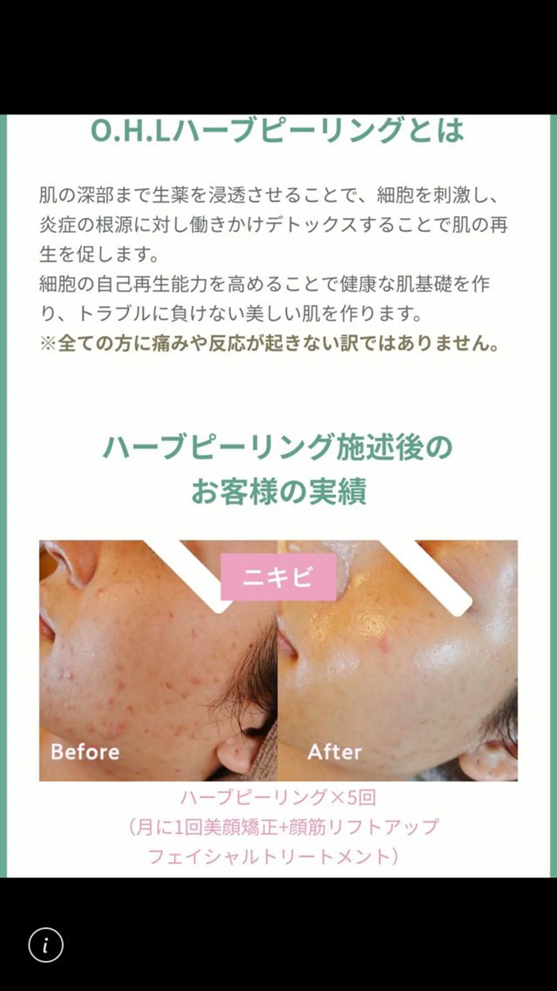 エステ 脱毛&シェービング専門店 心斎橋所属・脱毛&シェービング 専門店LUANAのエステ・リラクイメージ