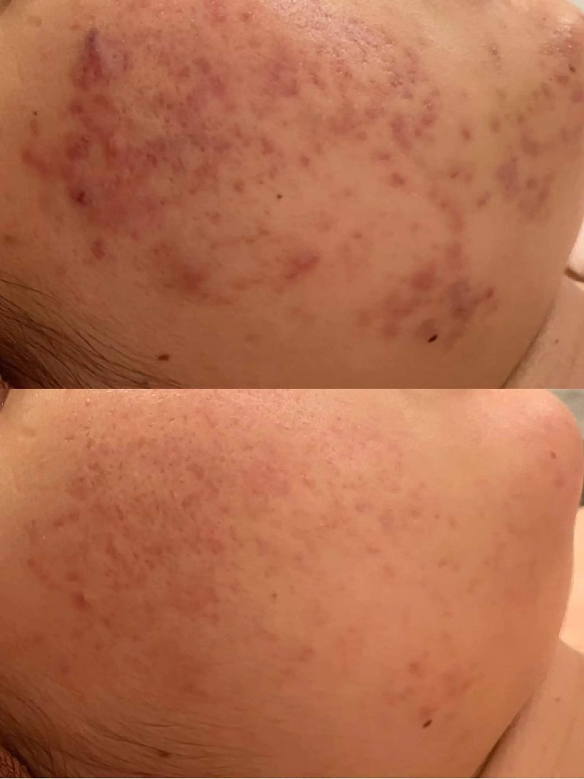 エステ リラク ニキビ・肌質改善専門 ♡人生が変わるサロンのエステ・リラクイメージ