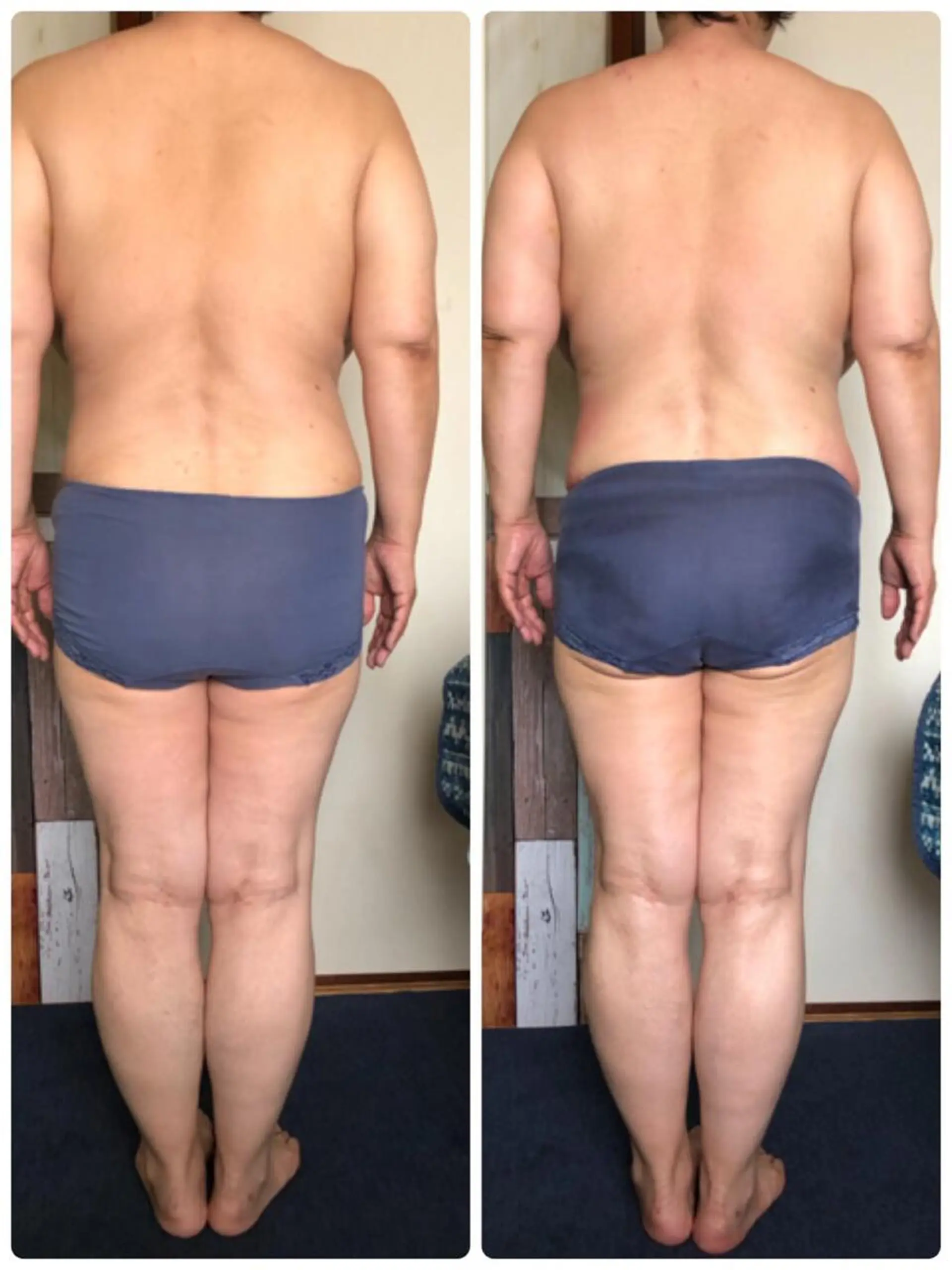 その他 ミリ ミリのエステ・リラクイメージ