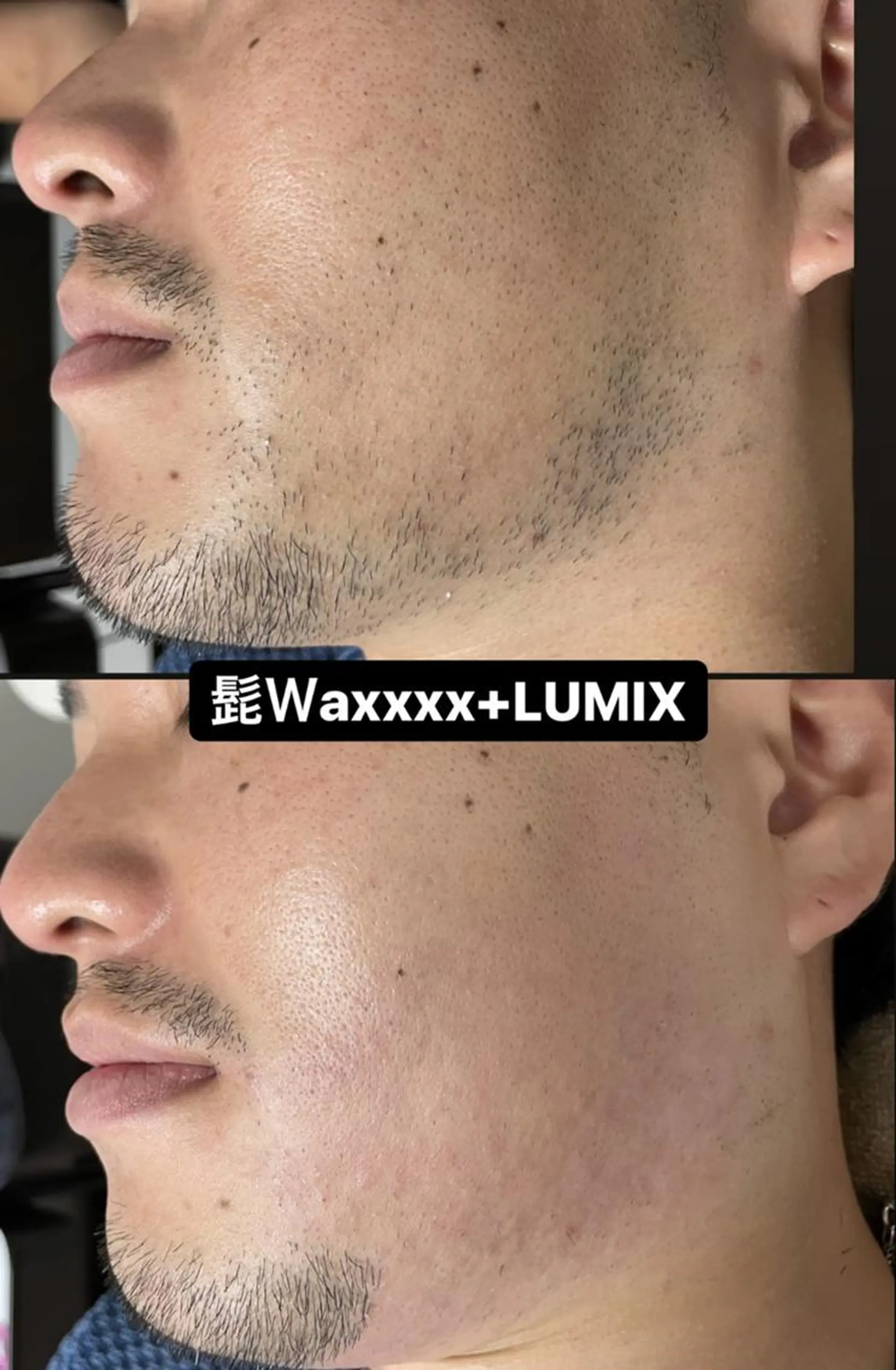 メンズ 脱毛 Epina 千葉店 【エピナ】のエステ・リラクイメージ